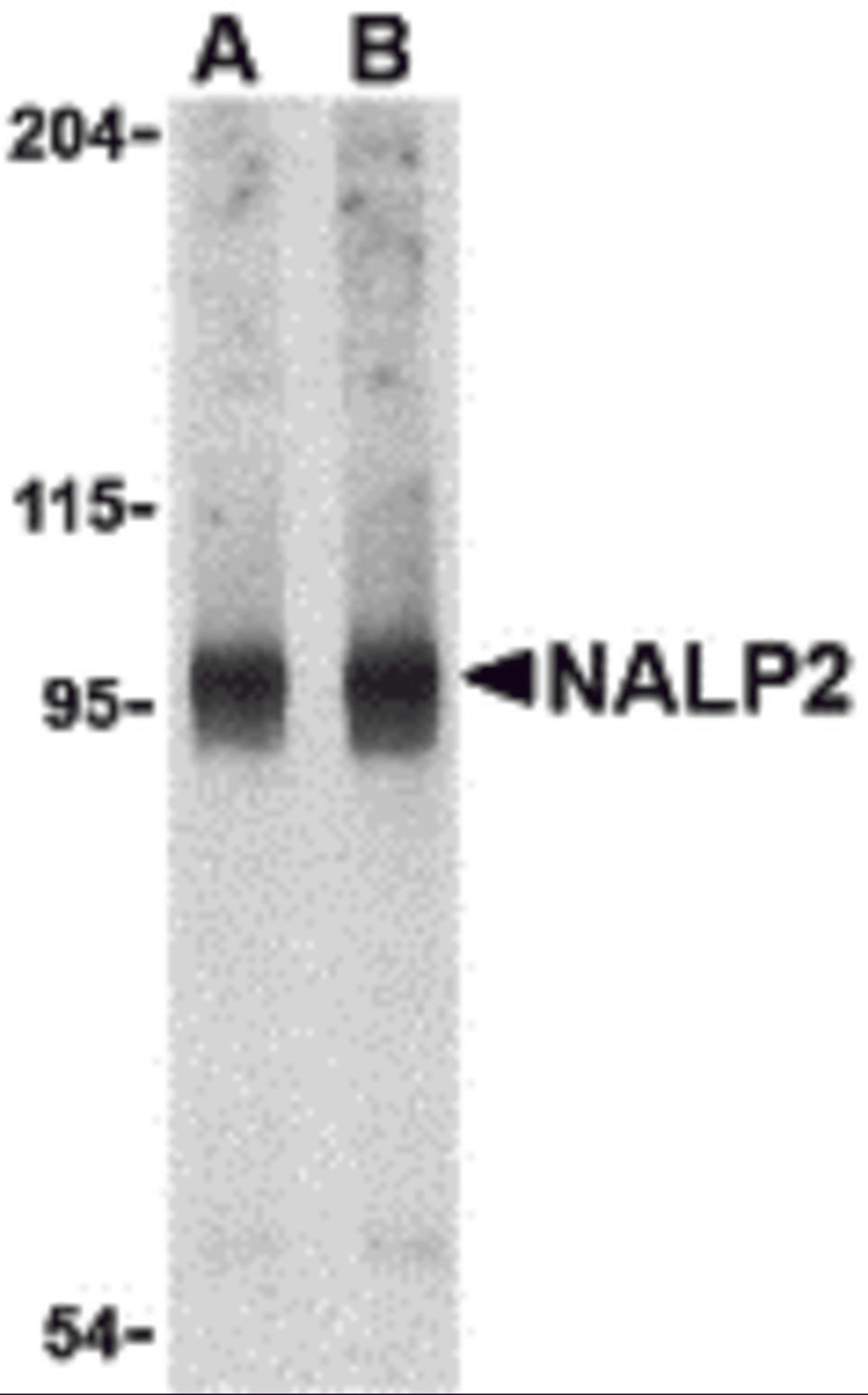 Western blot analysis of NALP2 in PC-3 cell lysate with NALP2 antibody at (A) 1 and (B) 2 μg/mL.