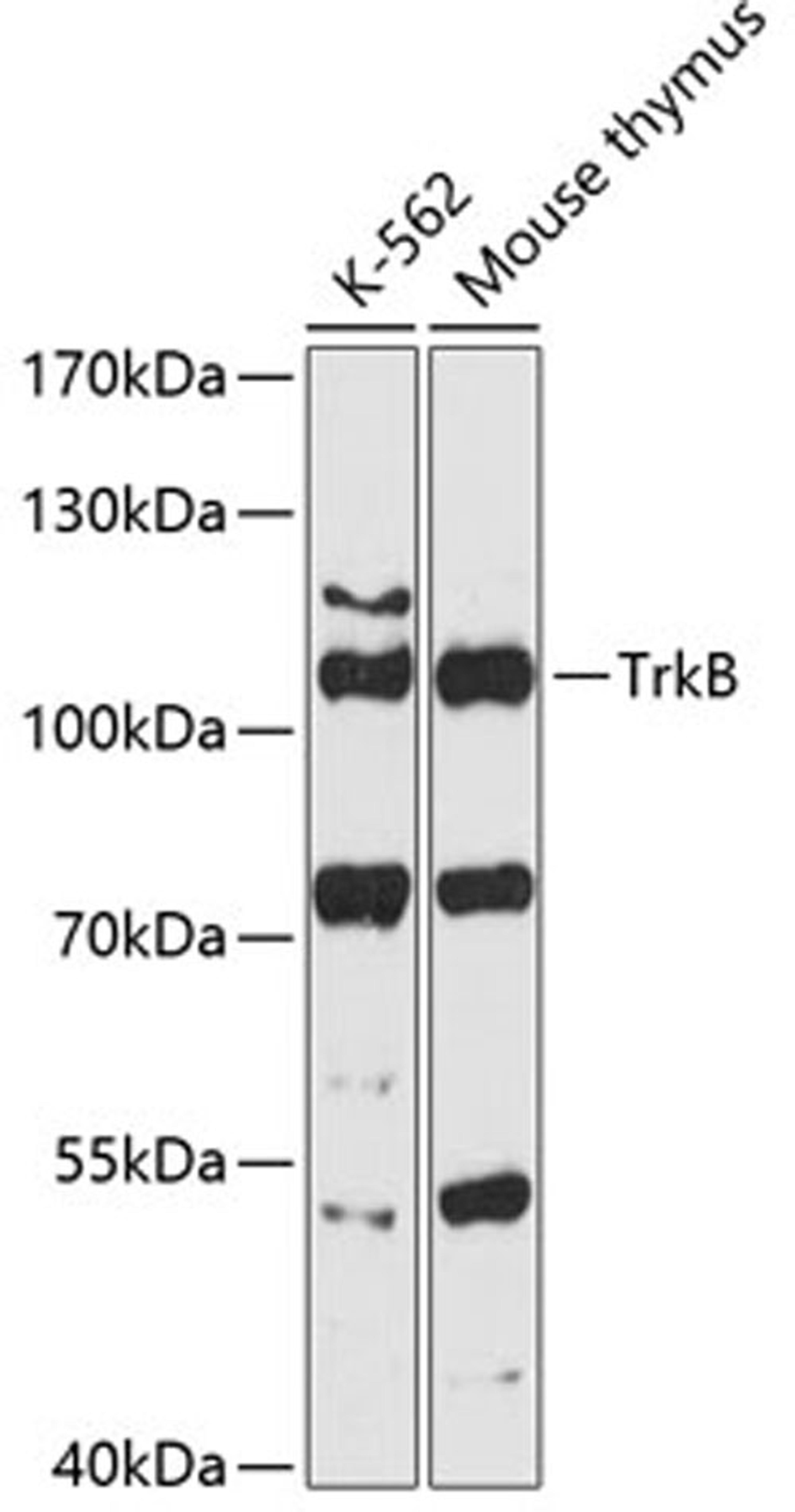 Western blot - TrkB antibody (A12325)