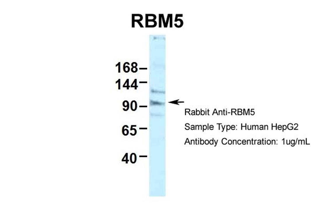 Antibody used in WB on Human HepG2.