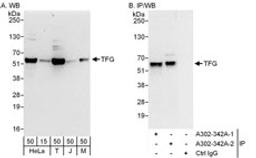 Detection of human and mouse TFG by western blot (h&m) and immunoprecipitation (h).