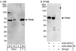 Detection of human TRM6 by western blot and immunoprecipitation.