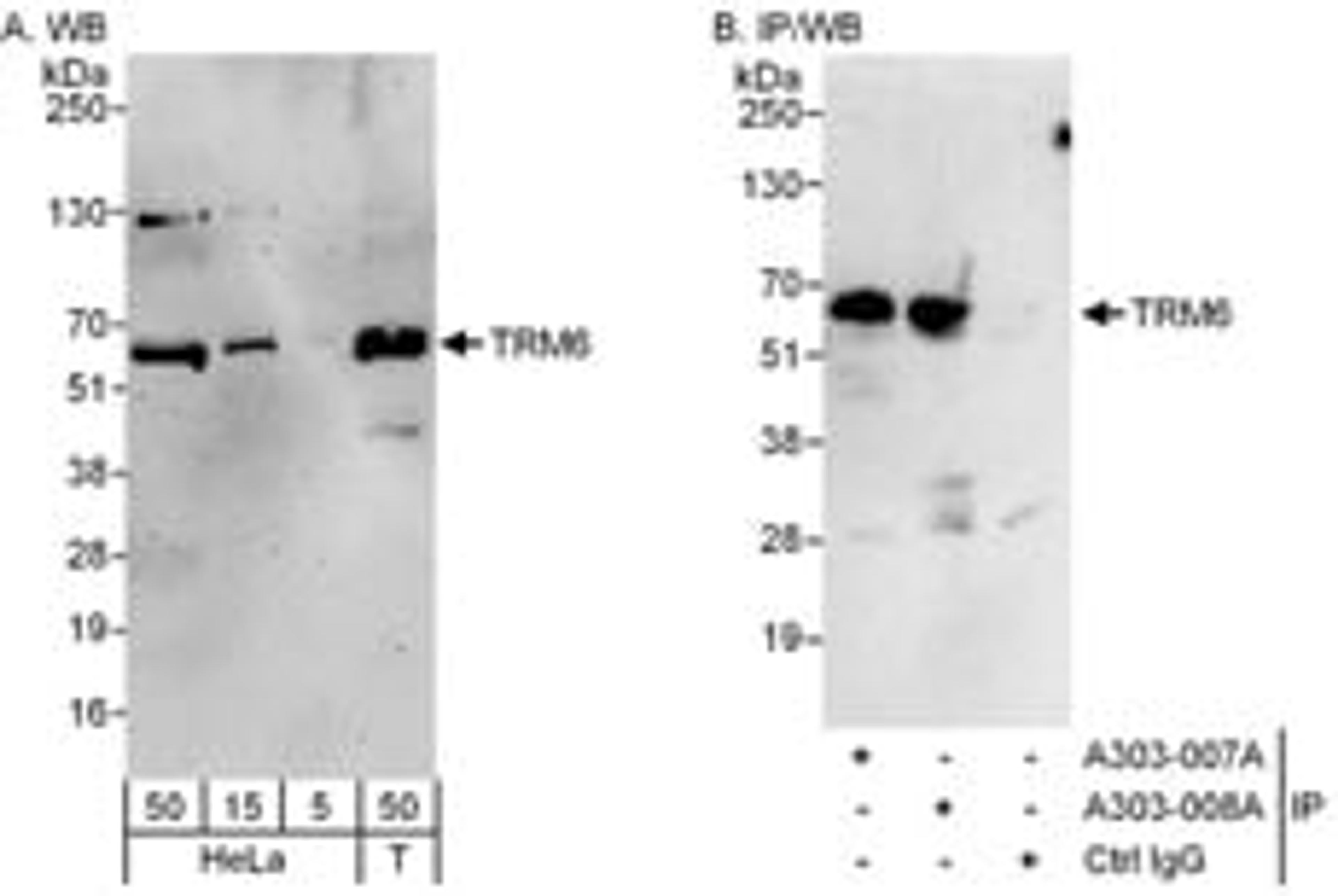 Detection of human TRM6 by western blot and immunoprecipitation.