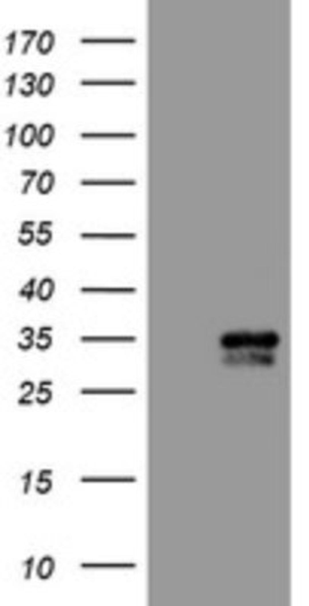 Western Blot: CXorf26 Antibody (5A11) [NBP2-46410] - Analysis of HEK293T cells were transfected with the pCMV6-ENTRY control (Left lane) or pCMV6-ENTRY CXorf26.