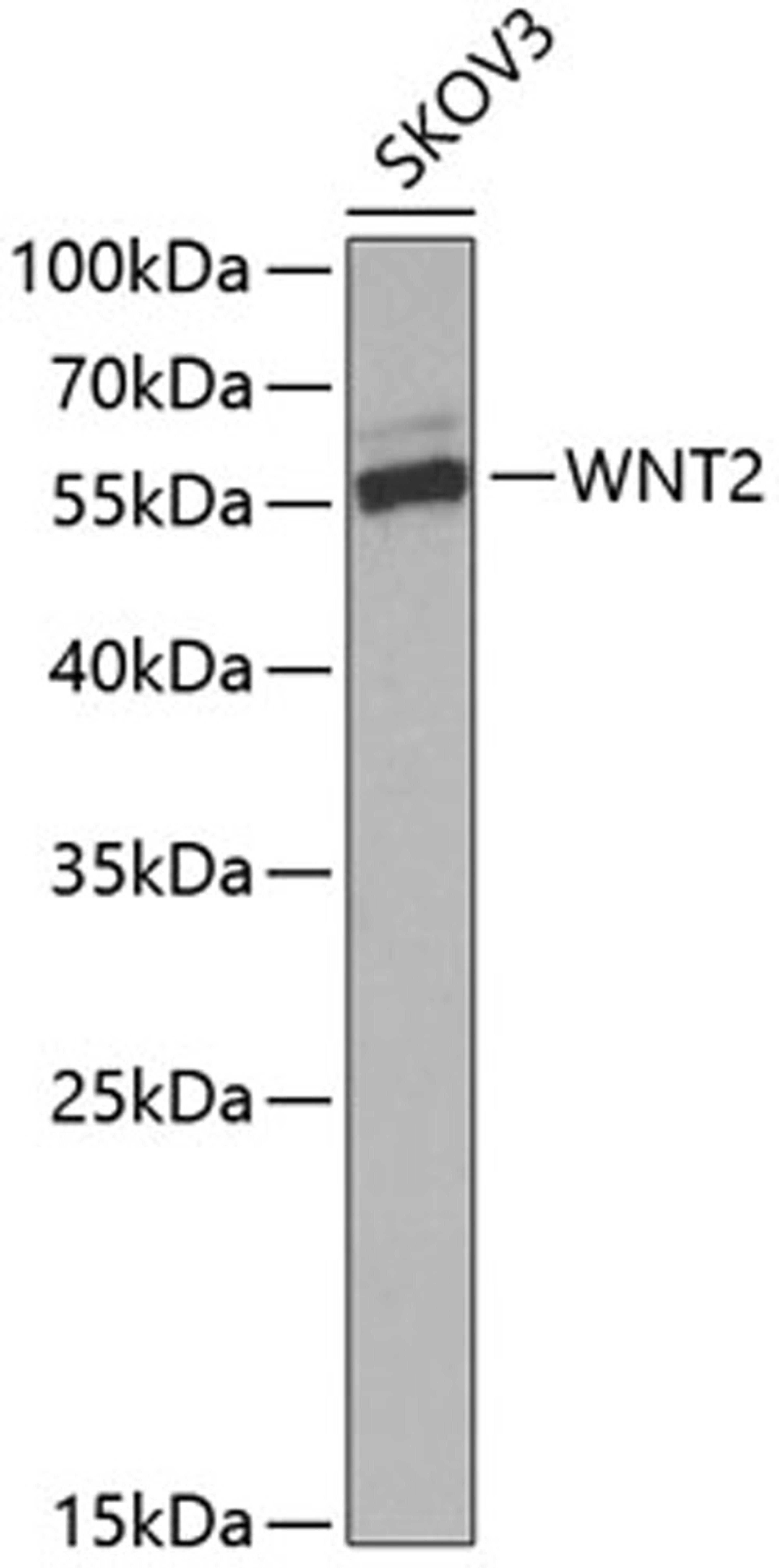 Western blot - WNT2 Antibody (A5864)