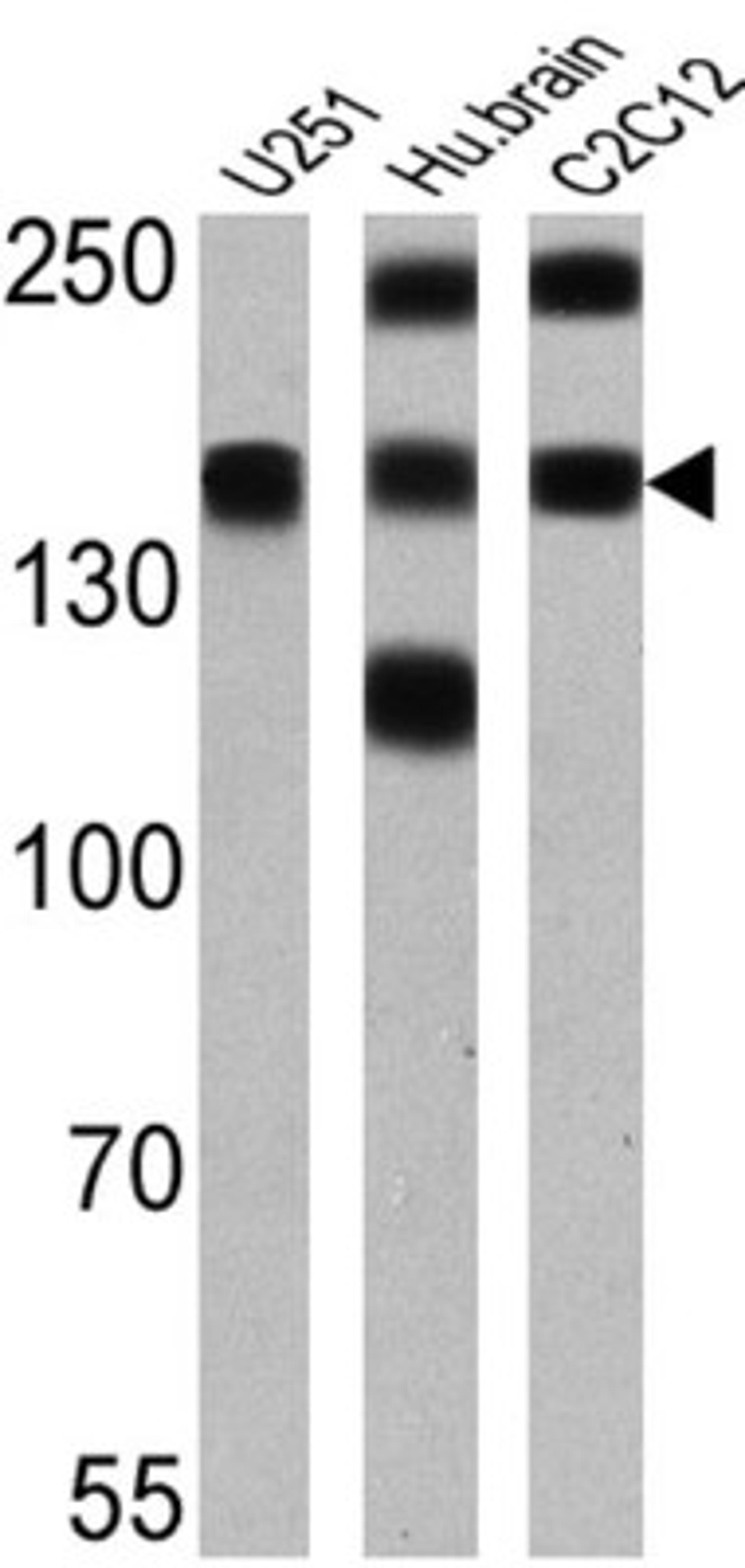 Western Blot: PMCA1 Antibody (5F10) [NB300-578] - Analysis of 25 ug of U251 (lane 1), human brain (lane 2) and C2C12 (lane 3).