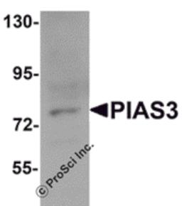 Western blot analysis of PIAS3 in K562 cell lysate with PIAS3 antibody at 1 μg/mL.