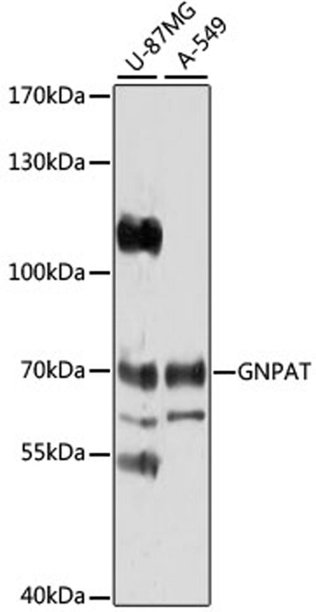 Western blot - GNPAT antibody (A4220)