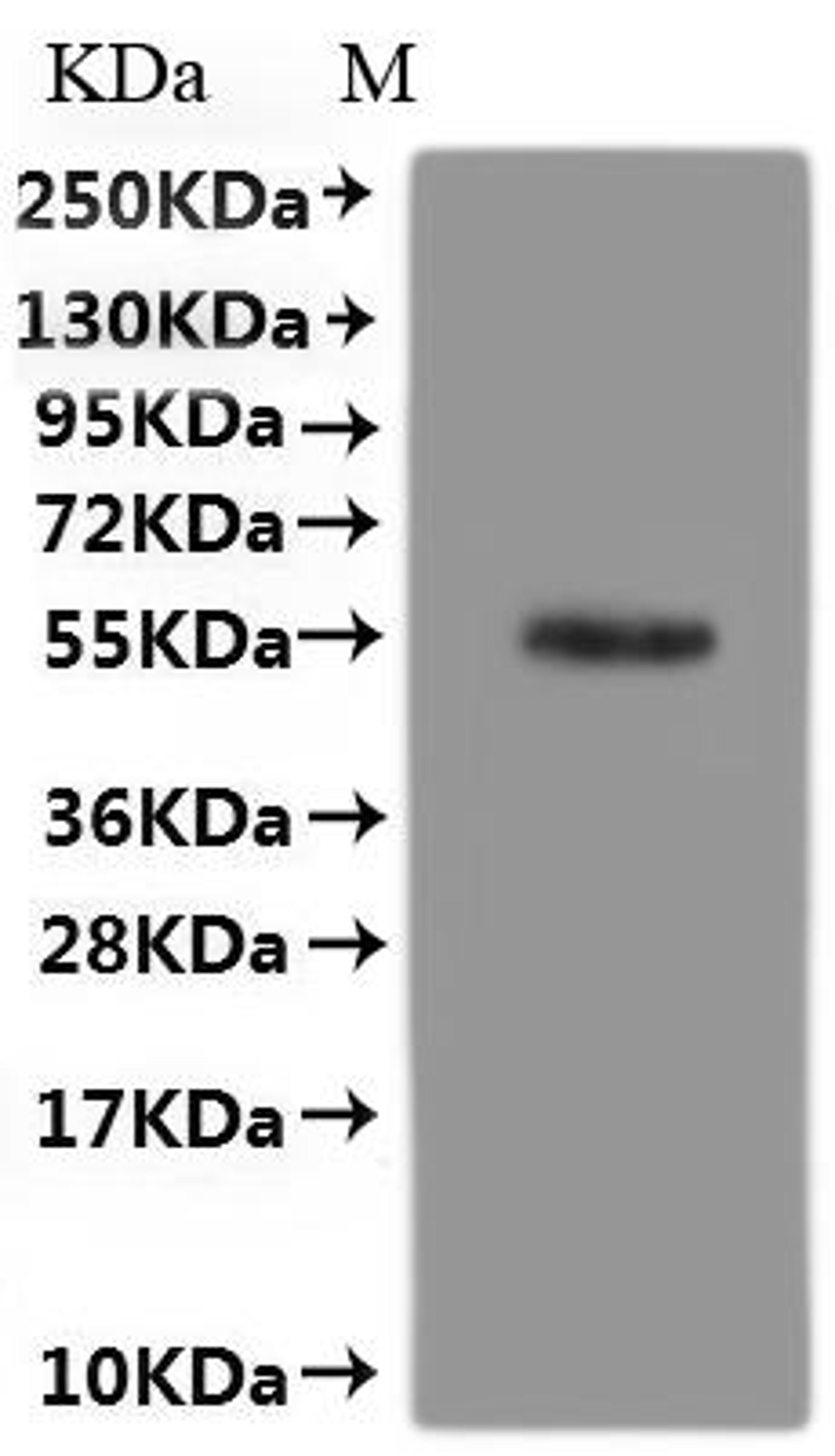 CSB-MP765056HU(A4) is detected by Mouse anti-6*His monoclonal antibody.