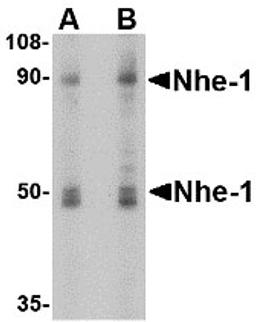 Western blot analysis of Nhe-1 in MOLT4 cell lysate with in with Nhe-1 antibody at (A) 1 and (B) 2 &#956;g/mL.