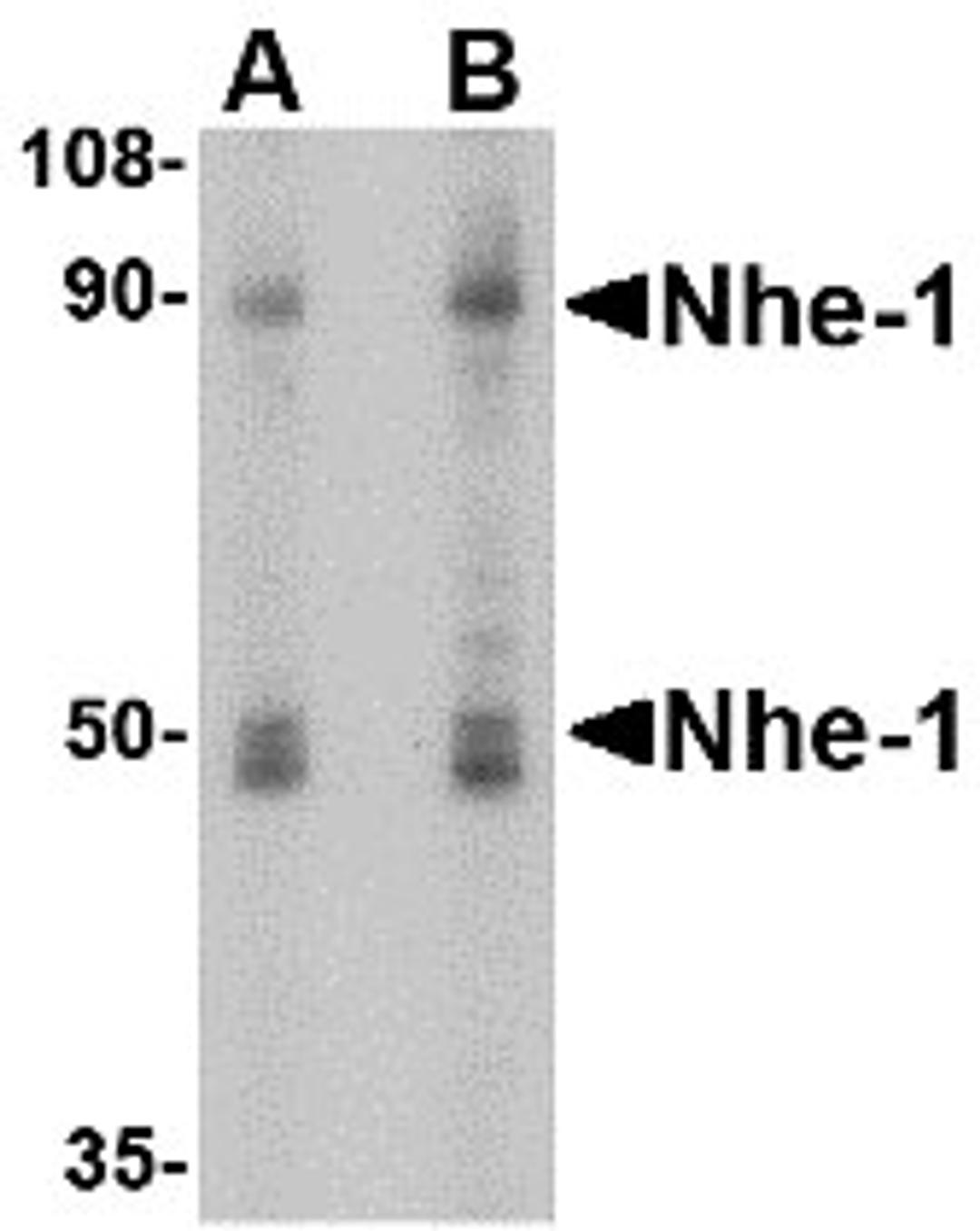 Western blot analysis of Nhe-1 in MOLT4 cell lysate with in with Nhe-1 antibody at (A) 1 and (B) 2 μg/mL.