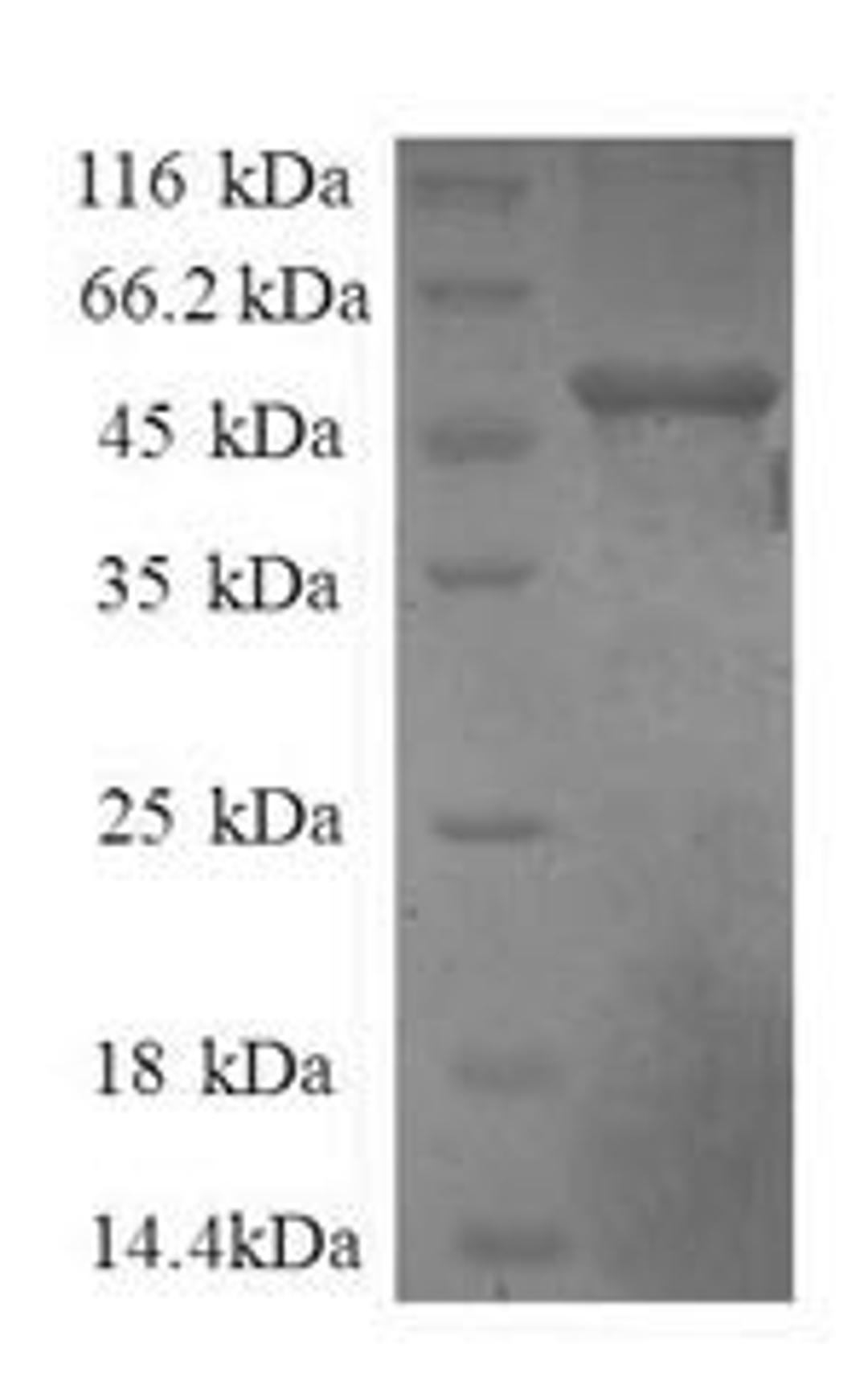 (Tris-Glycine gel) Discontinuous SDS-PAGE (reduced) with 5% enrichment gel and 15% separation gel.