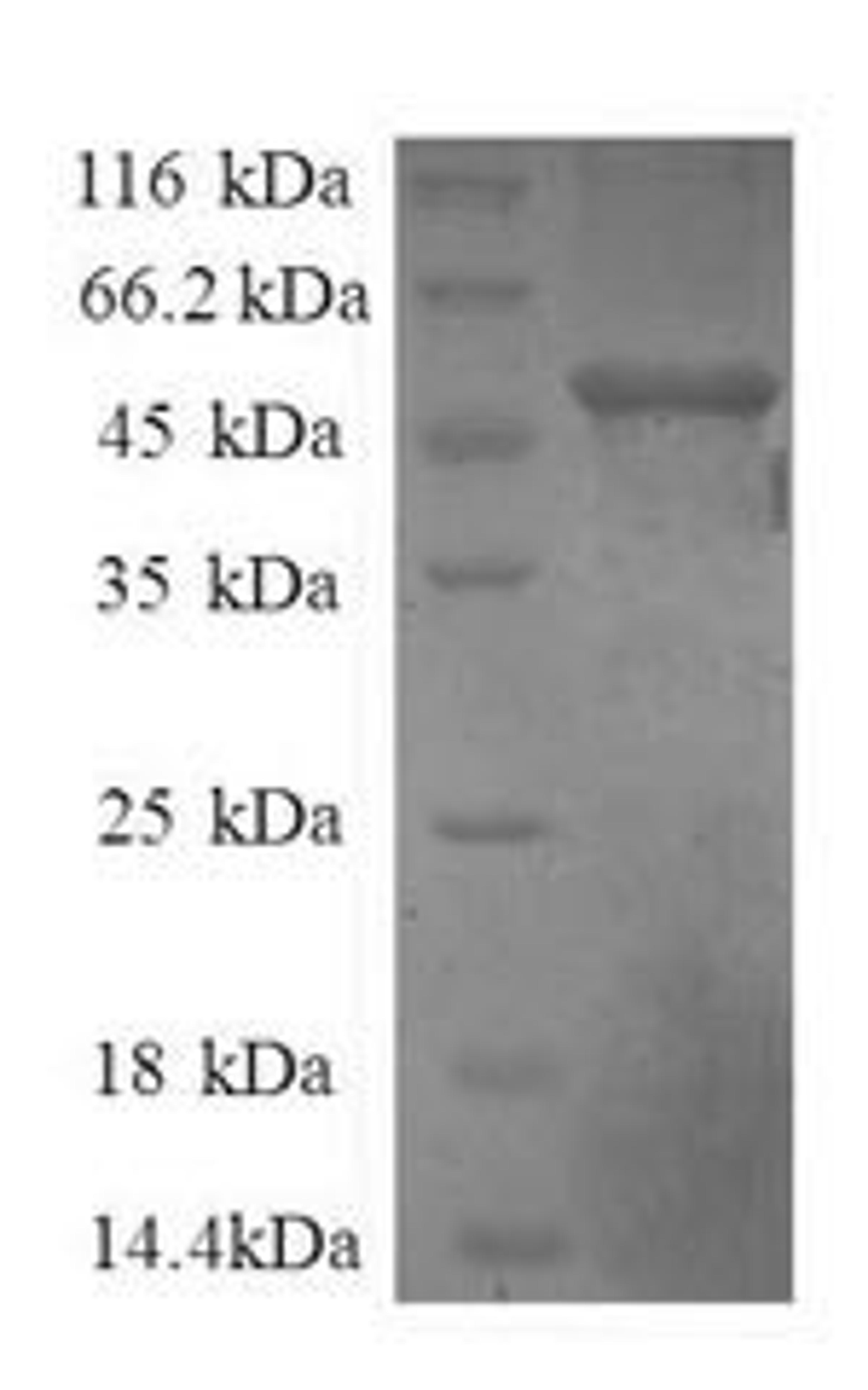 (Tris-Glycine gel) Discontinuous SDS-PAGE (reduced) with 5% enrichment gel and 15% separation gel.