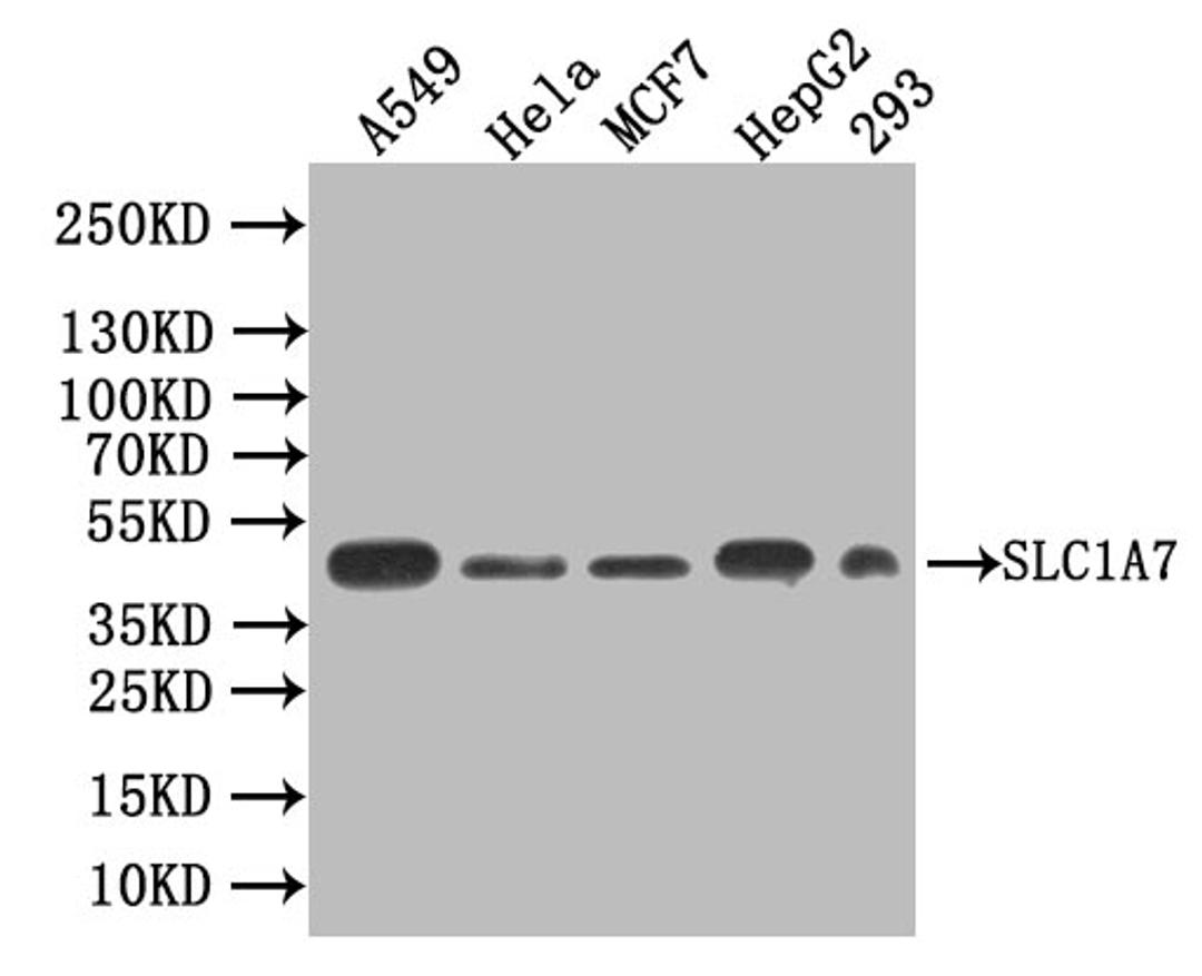 Western blot. All lanes: SLC1A7antibody IgG at 1.55ug/ml + Rat heart tissue. Secondary. Goat polyclonal to rabbit IgG at 1/10000 dilution. Predicted band size: 61, 18 kDa. Observed band size: 61 kDa.
