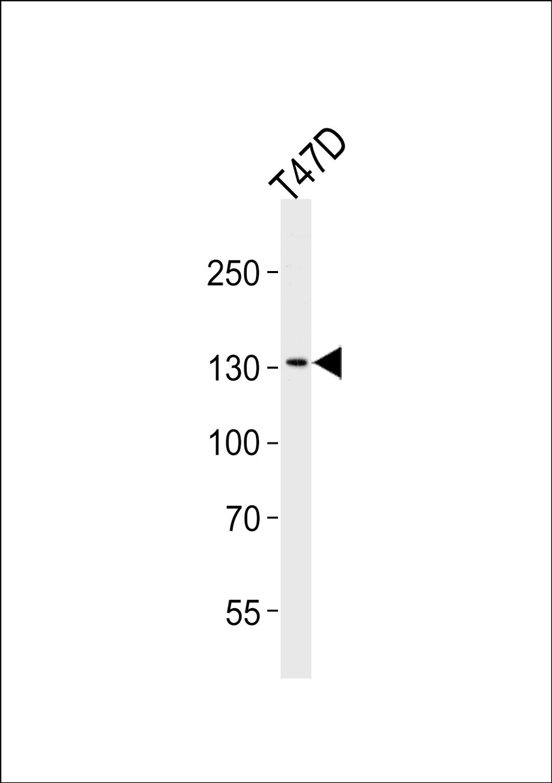 Western blot analysis of lysate from T47D cell line, using ATAD2 Antibody at 1:1000 at each lane.