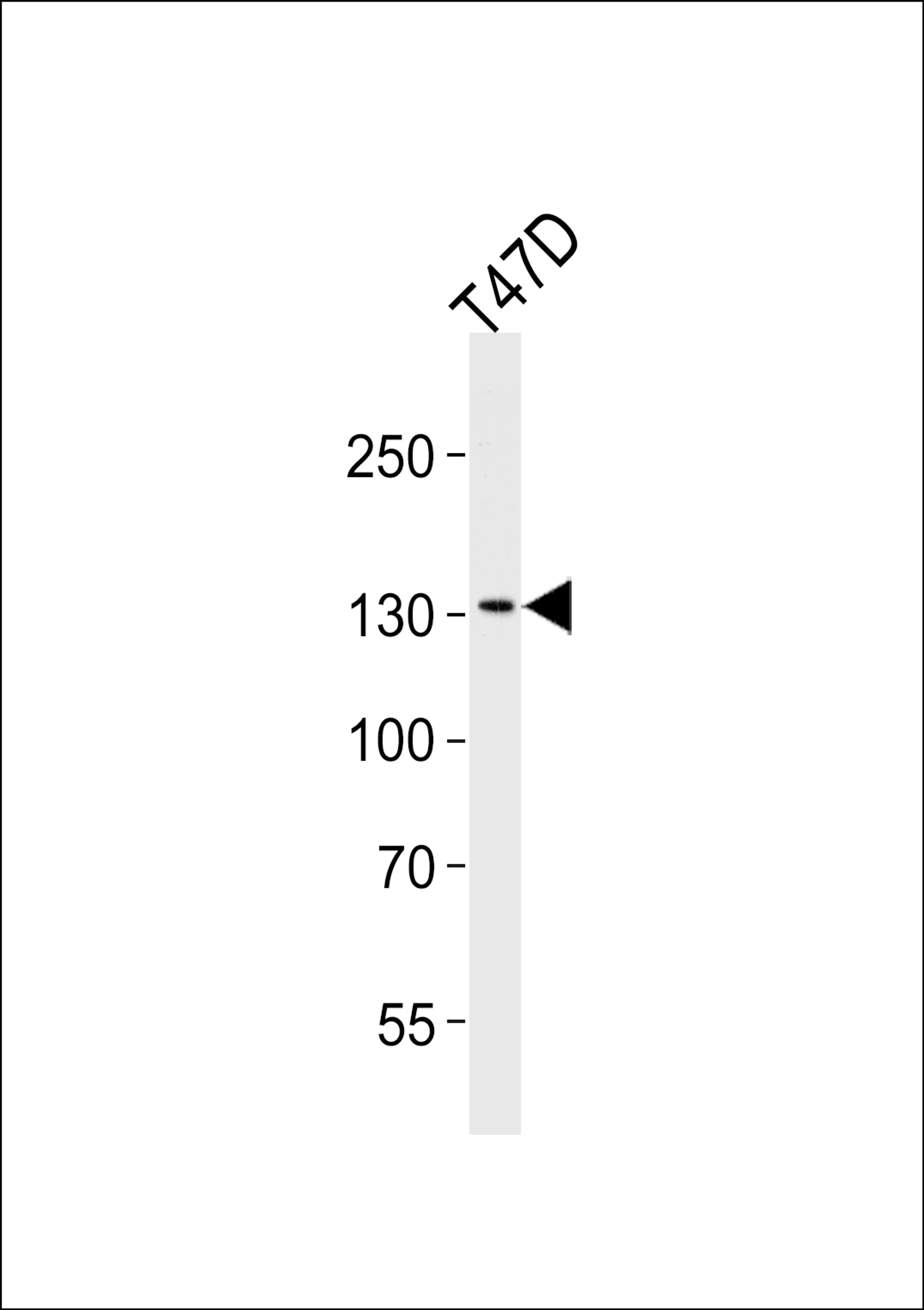 Western blot analysis of lysate from T47D cell line, using ATAD2 Antibody at 1:1000 at each lane.