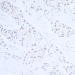 Detection of human EDD1 by immunohistochemistry.