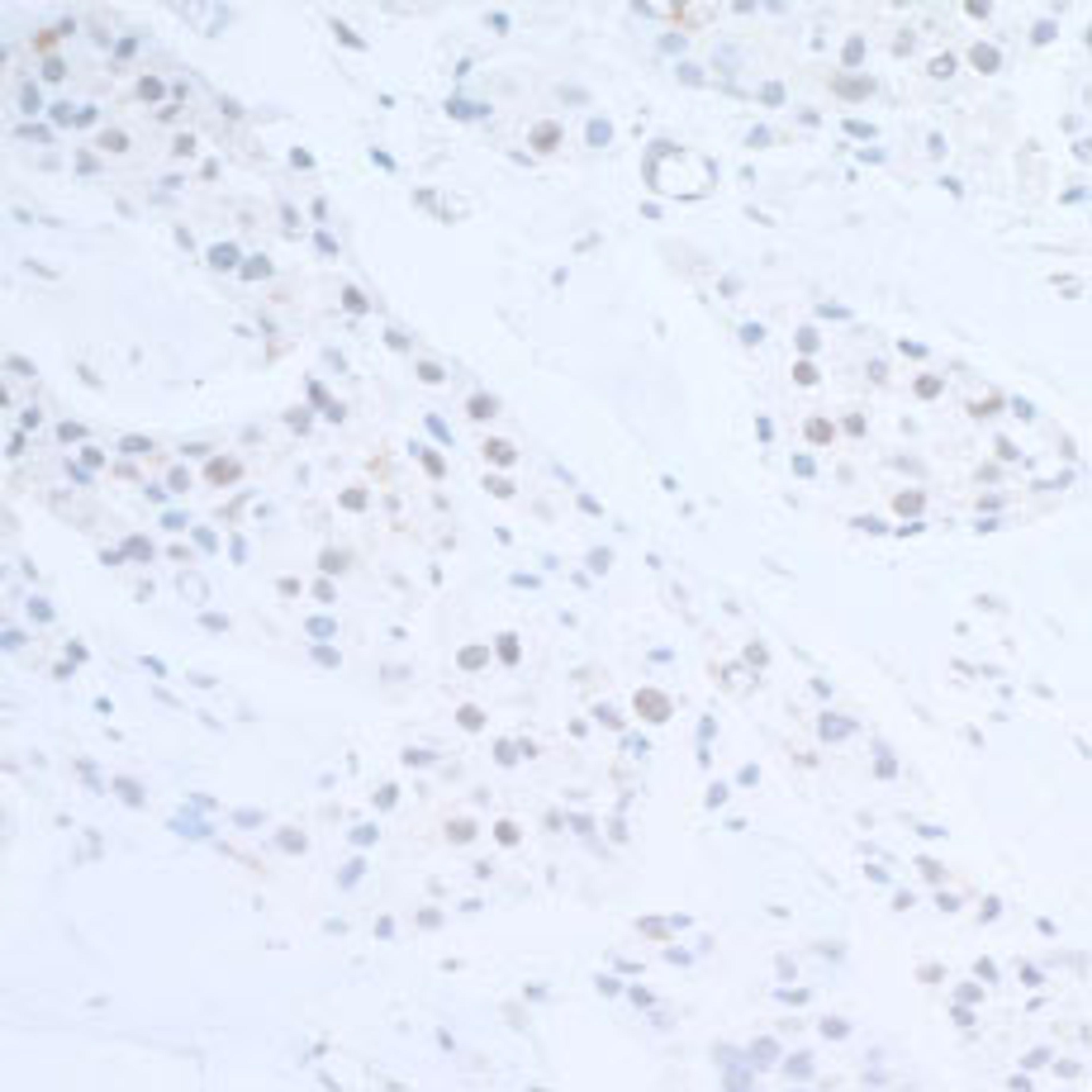 Detection of human EDD1 by immunohistochemistry.