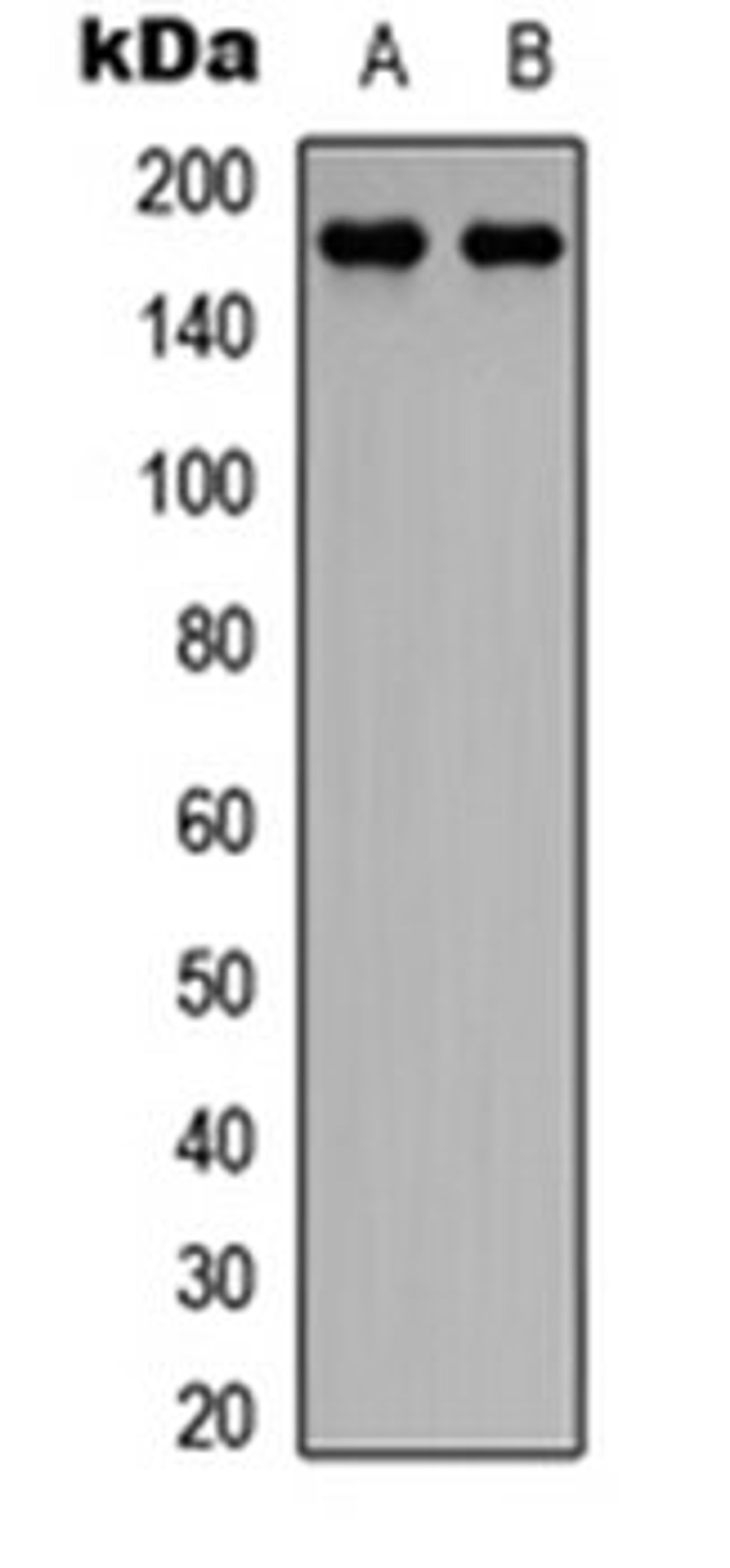 Western blot analysis of HeLa (Lane 1), Jurkat (Lane 2) whole cell lysates using CEP170 antibody