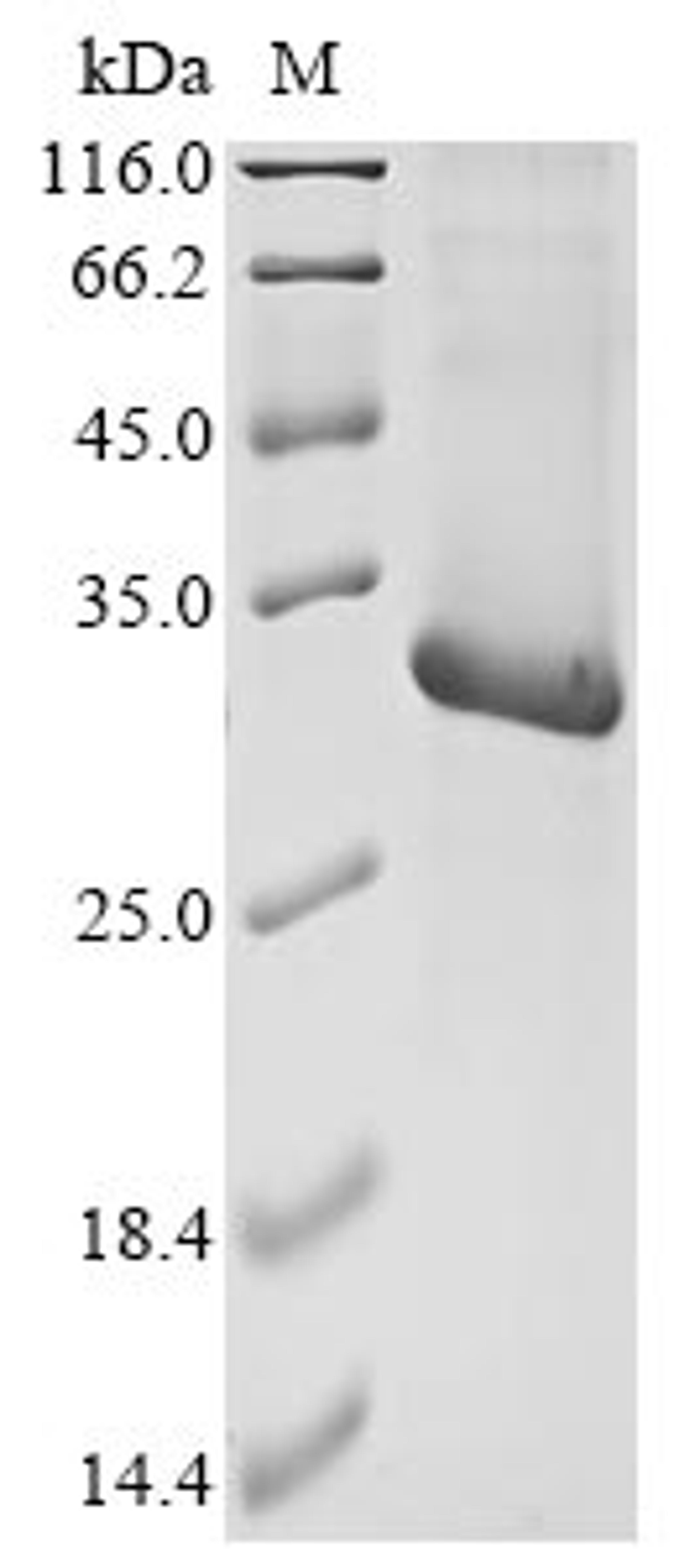 (Tris-Glycine gel) Discontinuous SDS-PAGE (reduced) with 5% enrichment gel and 15% separation gel.