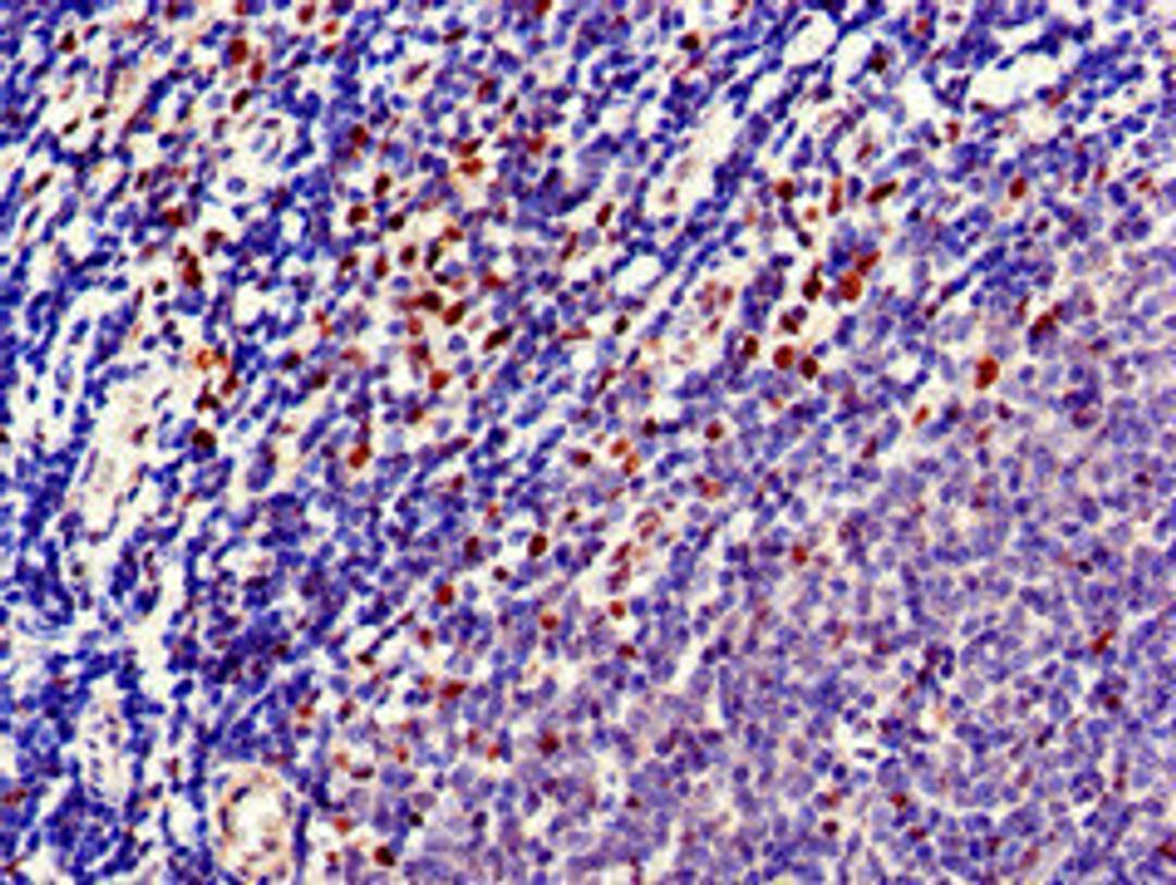 Immunohistochemistry of paraffin-embedded human lymph node tissue using CSB-PA025251LA01HU at dilution of 1:100