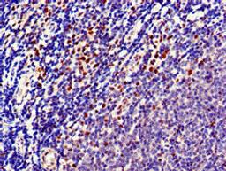 Immunohistochemistry of paraffin-embedded human lymph node tissue using CSB-PA025251LA01HU at dilution of 1:100