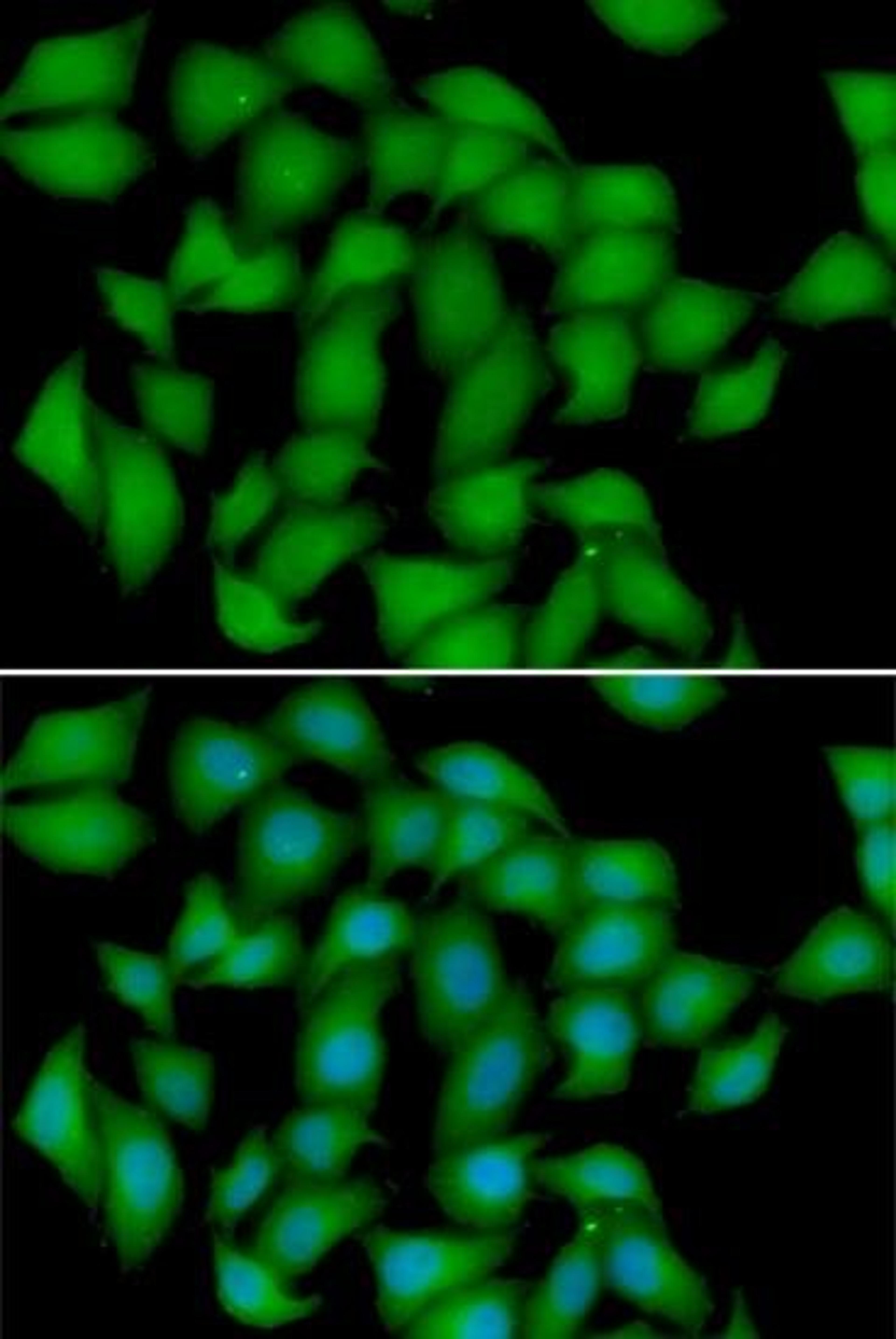 Immunofluorescence analysis of HeLa cell using ATOX1 antibody