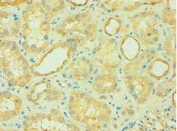 Immunohistochemistry of paraffin-embedded human kidney tissue using CSB-PA871592ESR2HU at dilution of 1:100