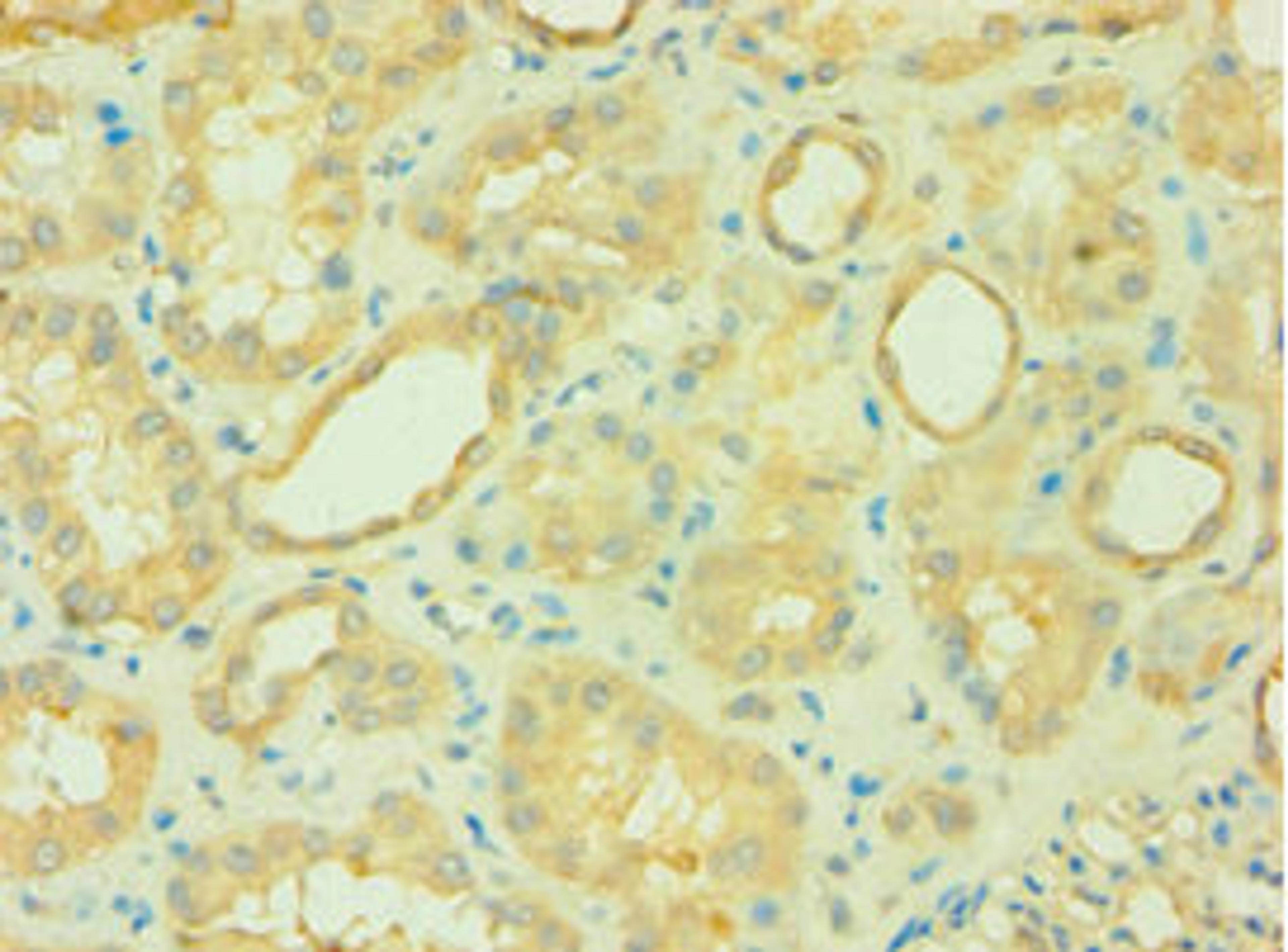 Immunohistochemistry of paraffin-embedded human kidney tissue using CSB-PA871592ESR2HU at dilution of 1:100