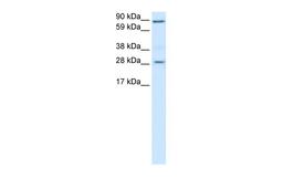 Antibody used in WB on Human Placenta at 0.2-1 ug/ml.