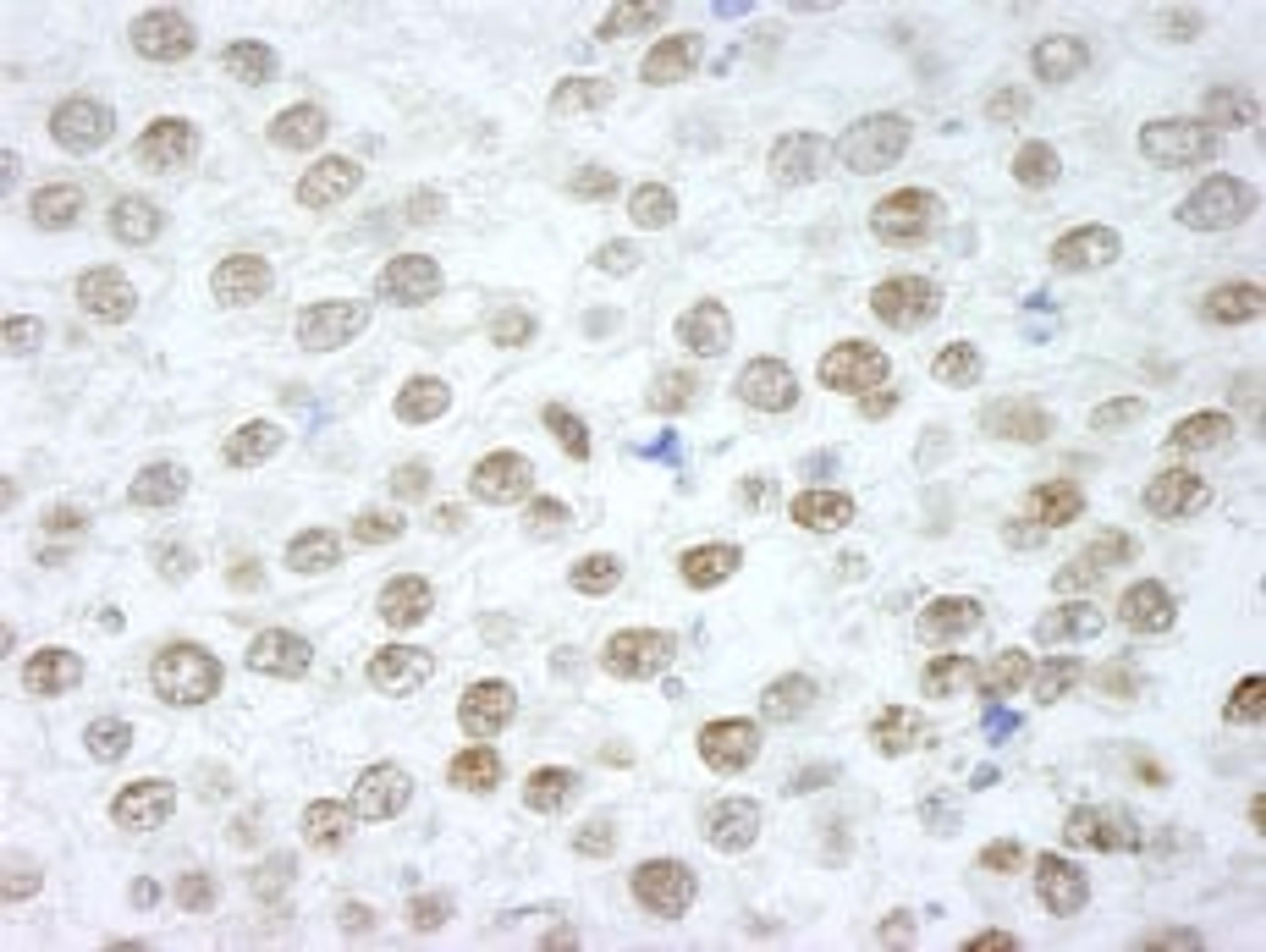 Detection of human RIF1 by immunohistochemistry.