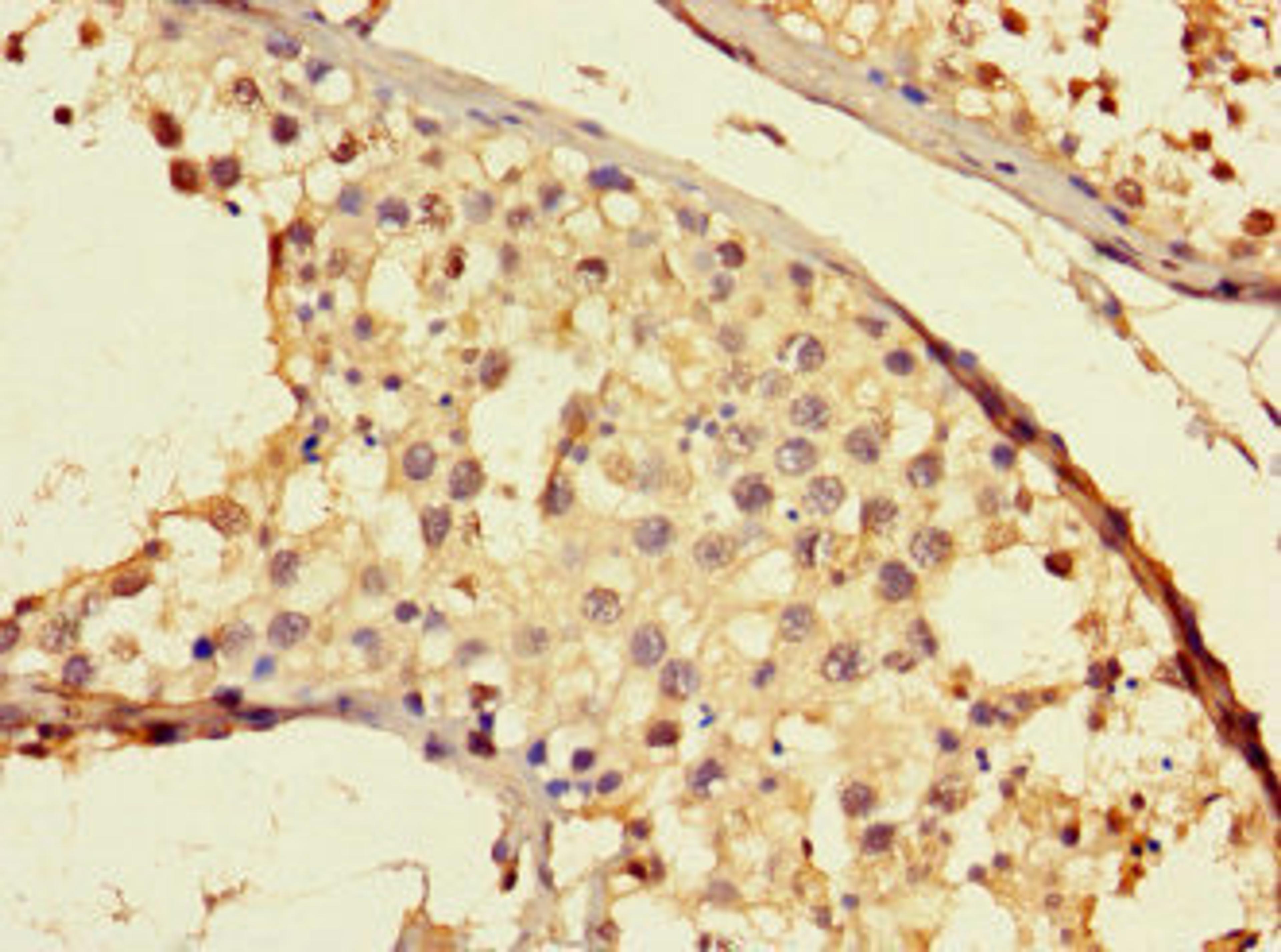 Immunohistochemistry of paraffin-embedded human testis tissue using CSB-PA751092LA01HU at dilution of 1:100