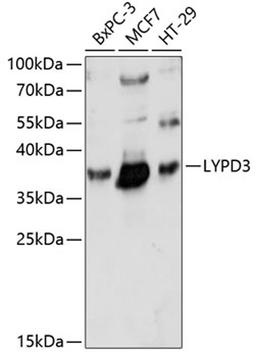 Western blot - LYPD3 antibody (A14873)