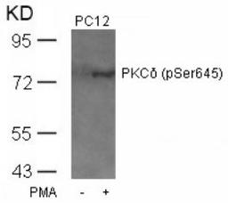 Western blot analysis of lysed extracts from PC12 cells untreated or treated with PMA using PKC&#948; (Phospho-Ser645).