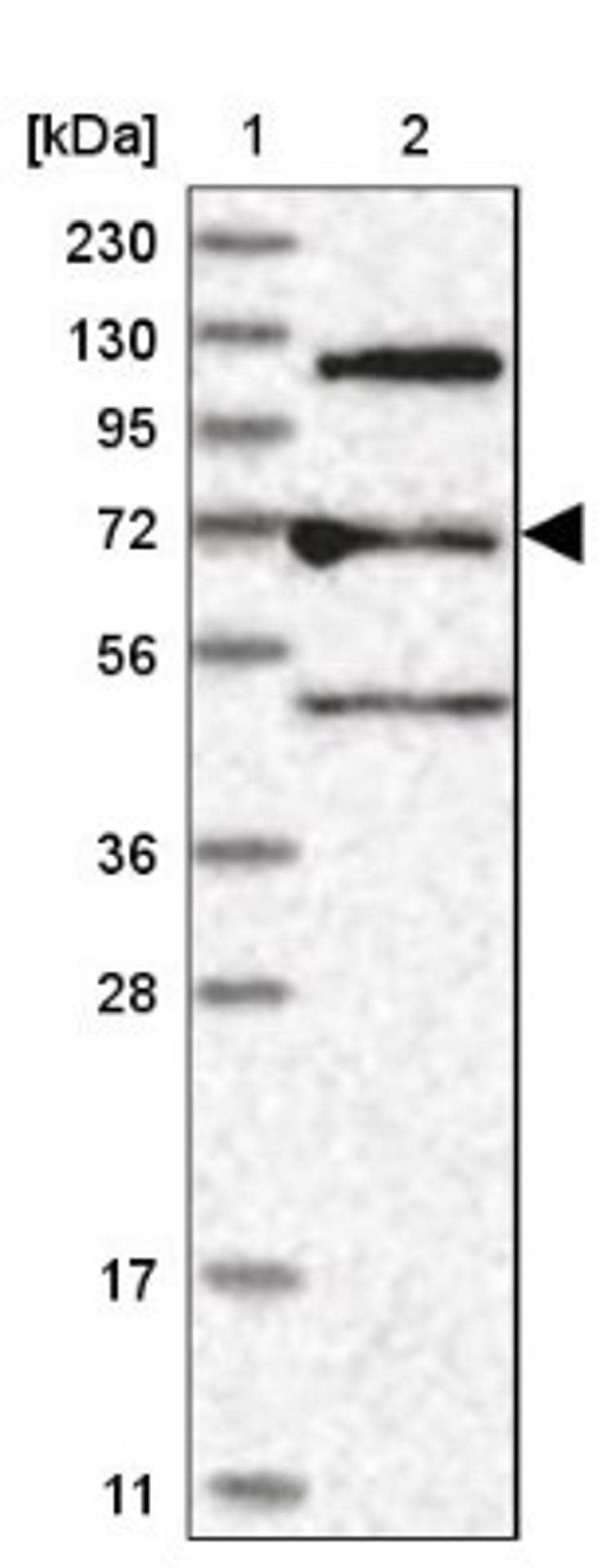 Western Blot: ARHGAP28 Antibody [NBP1-84640] - Lane 1: Marker [kDa] 230, 130, 95, 72, 56, 36, 28, 17, 11<br/>Lane 2: Human cell line RT-4