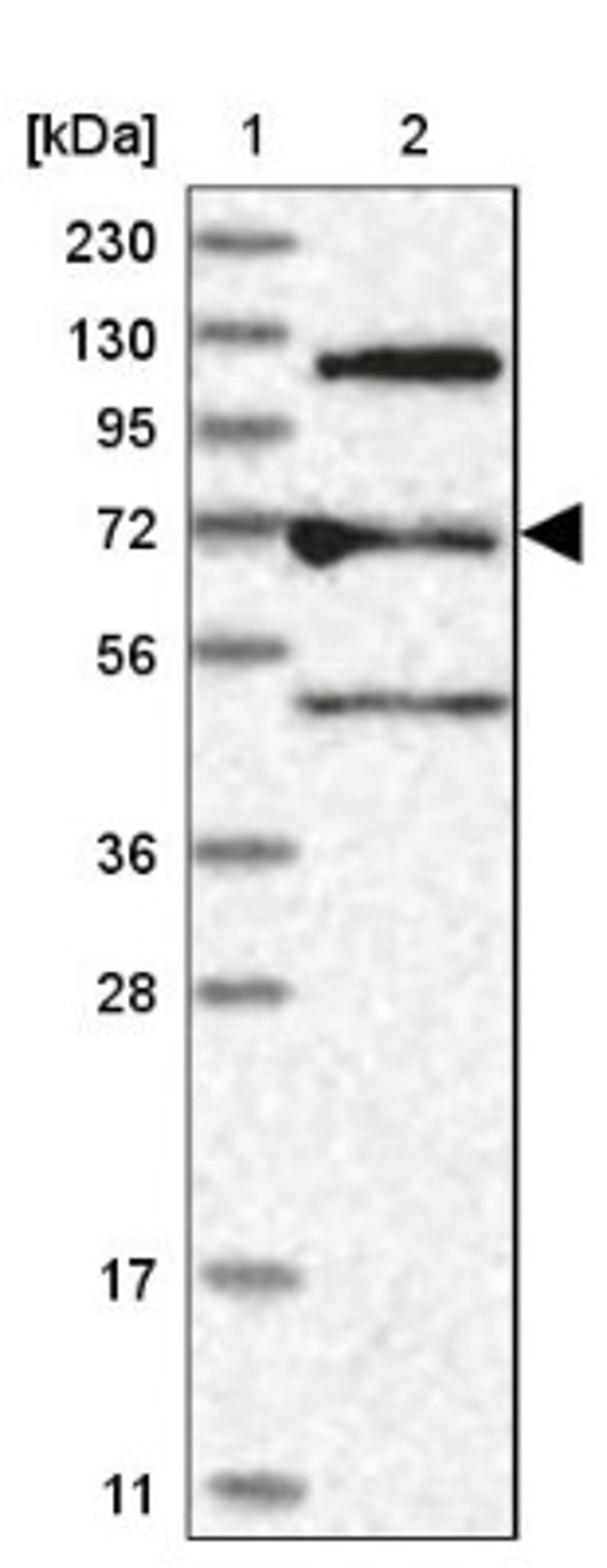 Western Blot: ARHGAP28 Antibody [NBP1-84640] - Lane 1: Marker [kDa] 230, 130, 95, 72, 56, 36, 28, 17, 11<br/>Lane 2: Human cell line RT-4