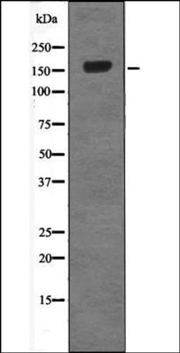 Western blot analysis of 293 whole cell lysates using Met -Phospho-Ser985- antibody