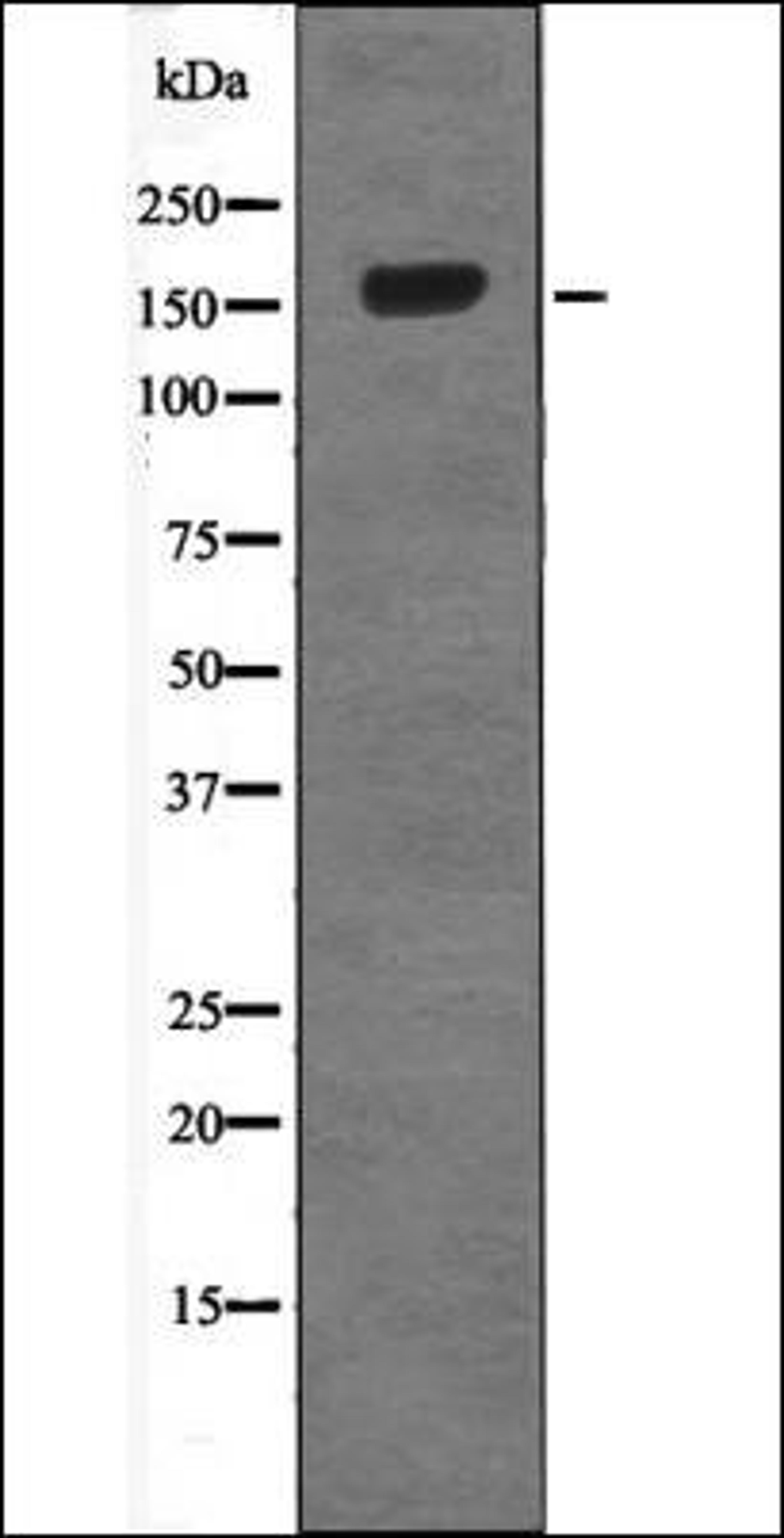 Western blot analysis of 293 whole cell lysates using Met -Phospho-Ser985- antibody