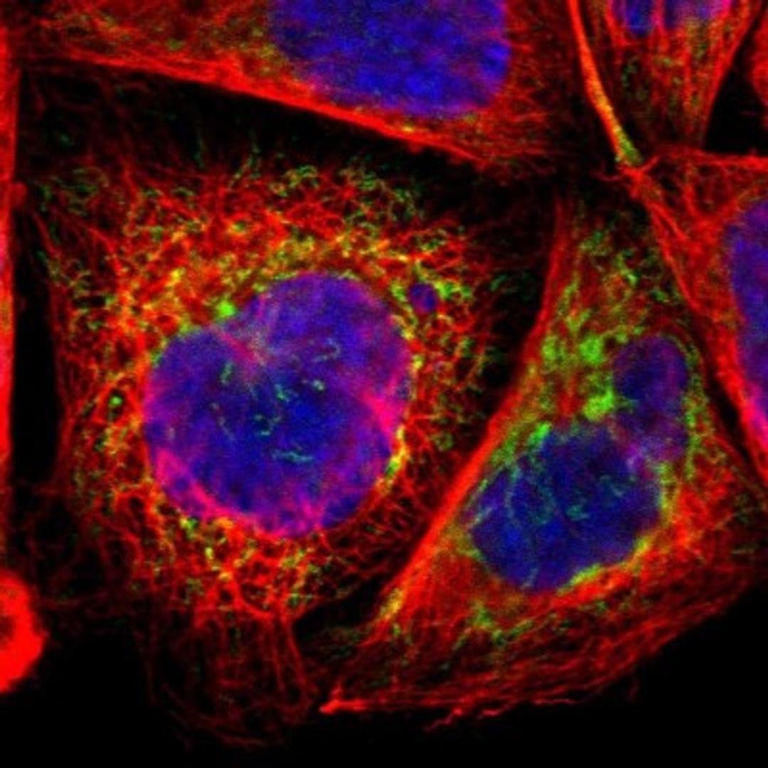 Immunocytochemistry/Immunofluorescence: CHCHD10 Antibody [NBP1-91169] - Staining of human cell line A-431 shows positivity in mitochondria.