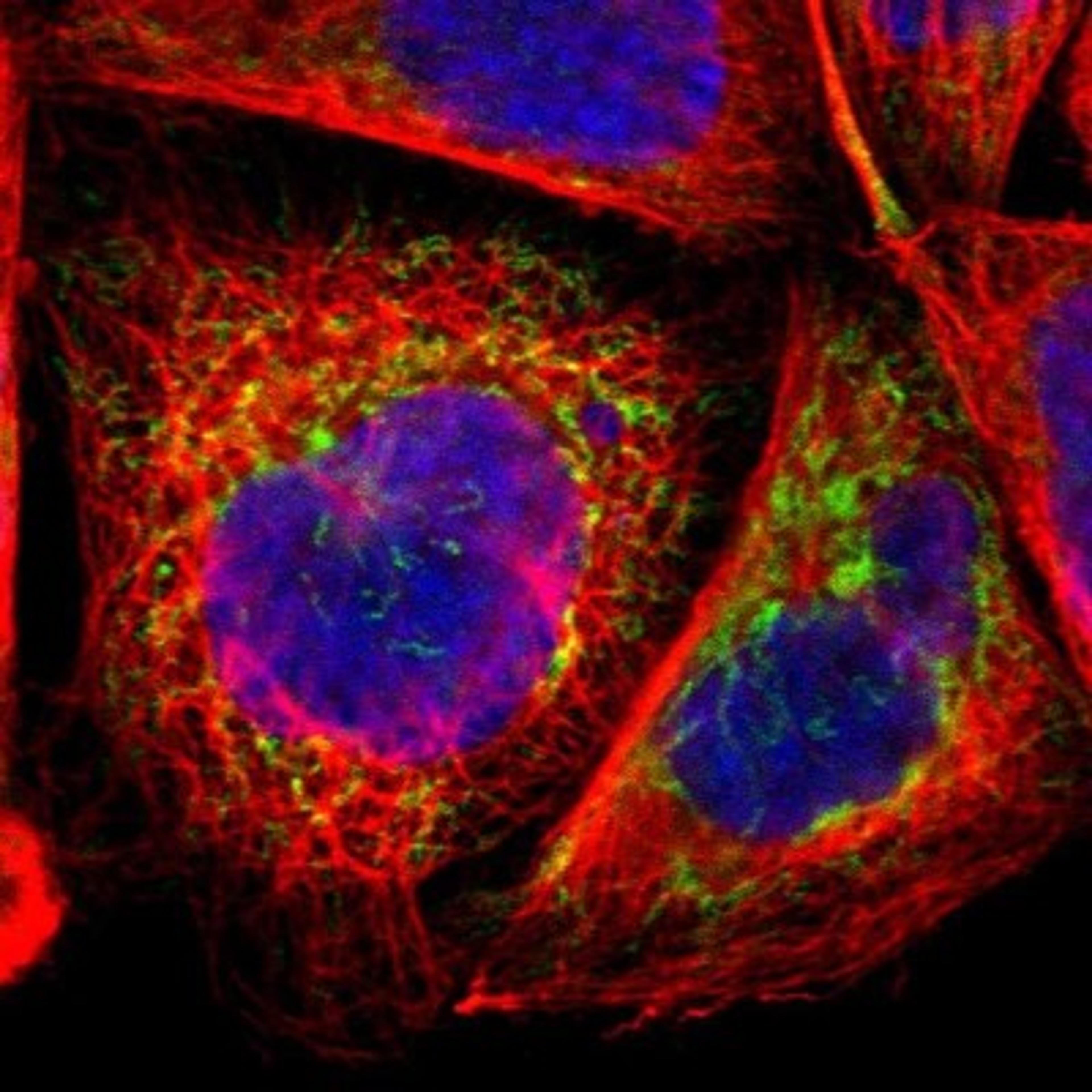 Immunocytochemistry/Immunofluorescence: CHCHD10 Antibody [NBP1-91169] - Staining of human cell line A-431 shows positivity in mitochondria.