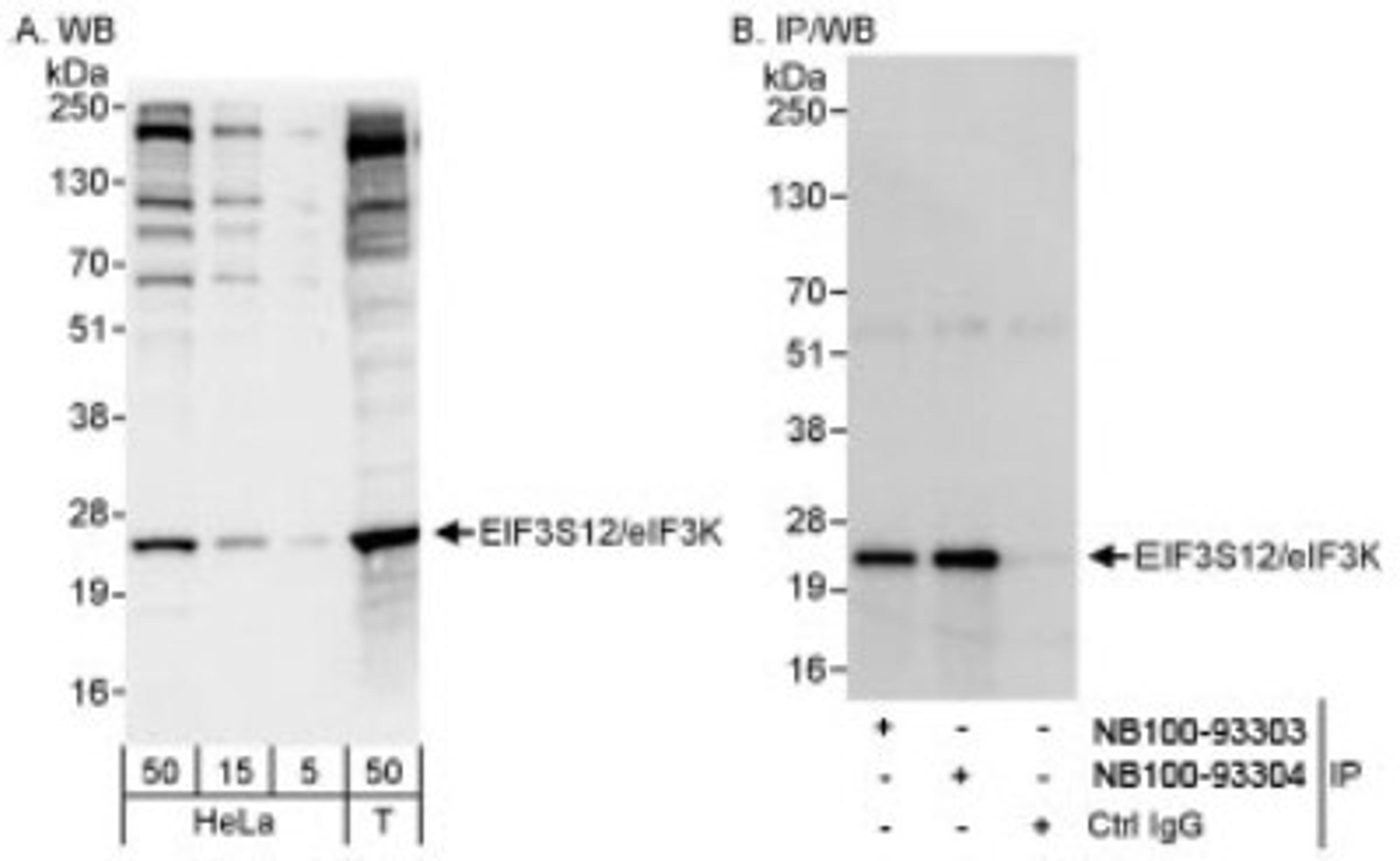 Western Blot: eIF3K Antibody [NB100-93304] - Detection of Human eIF3K/EIF3S12 on HeLa whole cell lysate using NB100-93304. eIF3K/EIF3S12 was also immunoprecipitated by rabbit anti-eIF3K/EIF3S12 antibody NB100-93303.