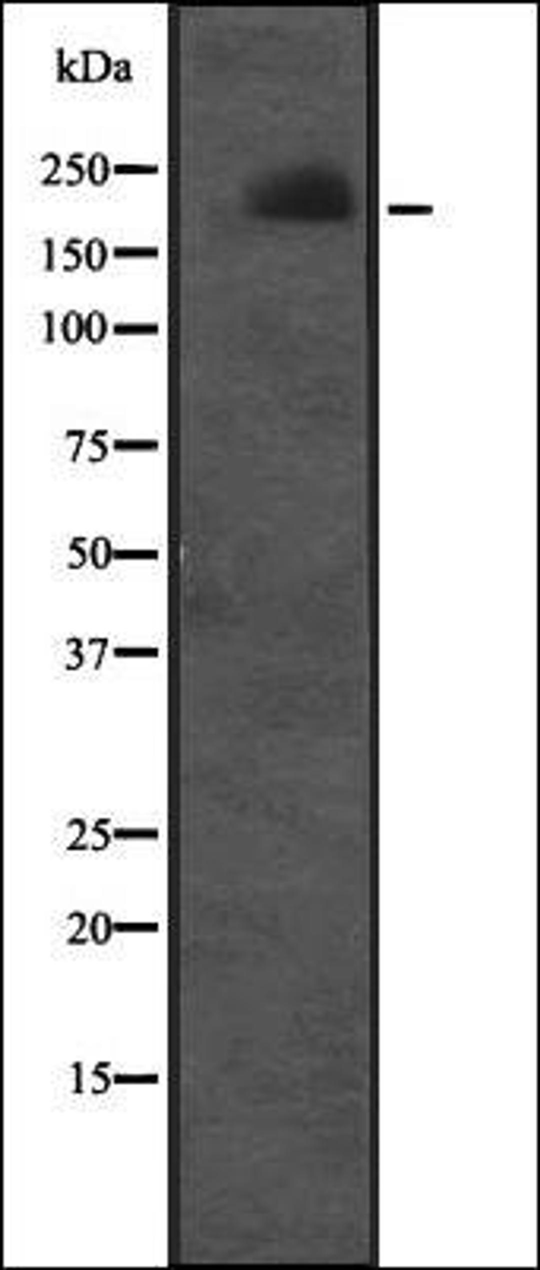 Western blot analysis of Molt-4 cell lysate using CUL7 antibody