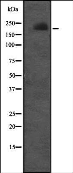 Western blot analysis of Molt-4 cell lysate using CUL7 antibody