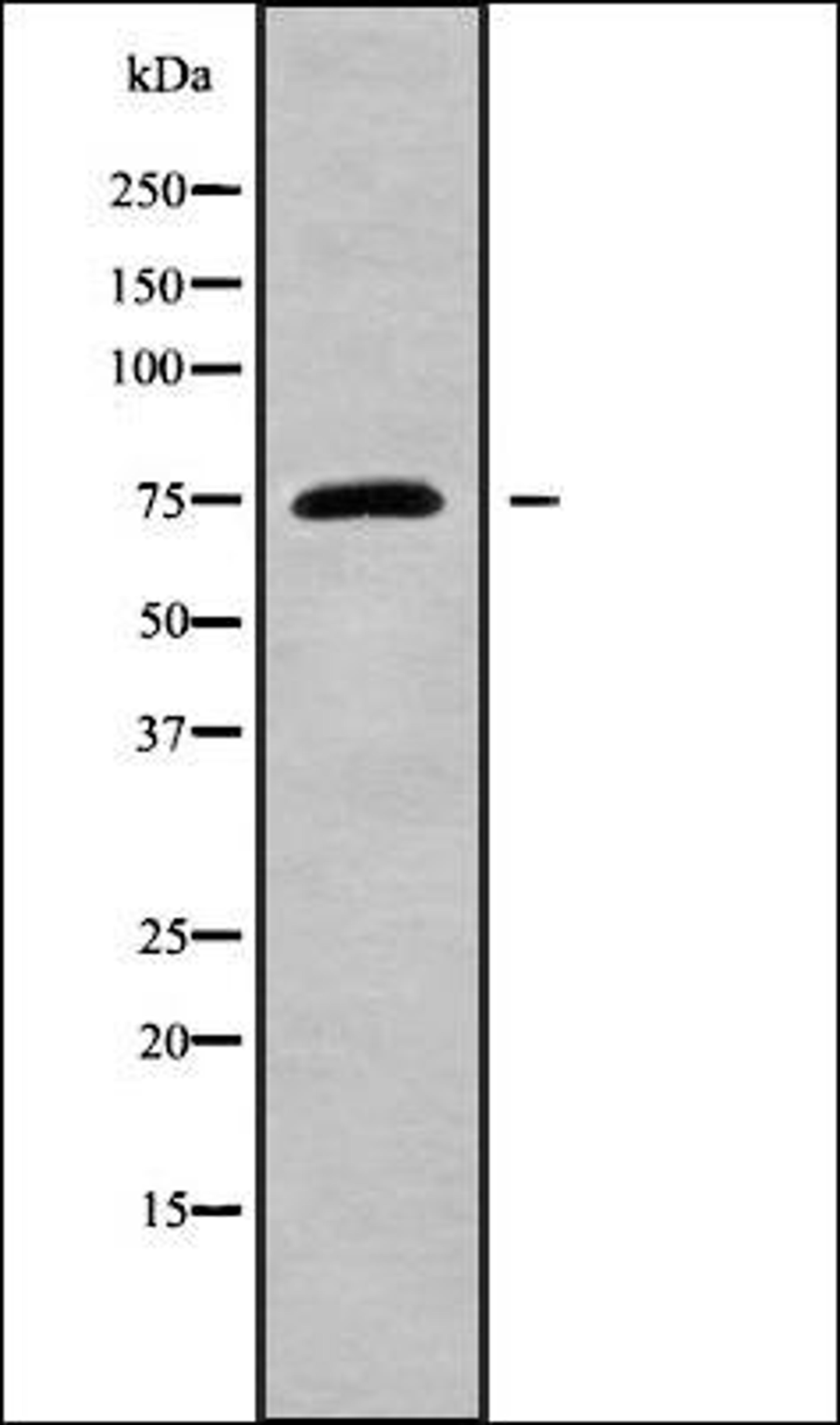 Western blot analysis of HeLa whole cell lysates using GPSM1 antibody