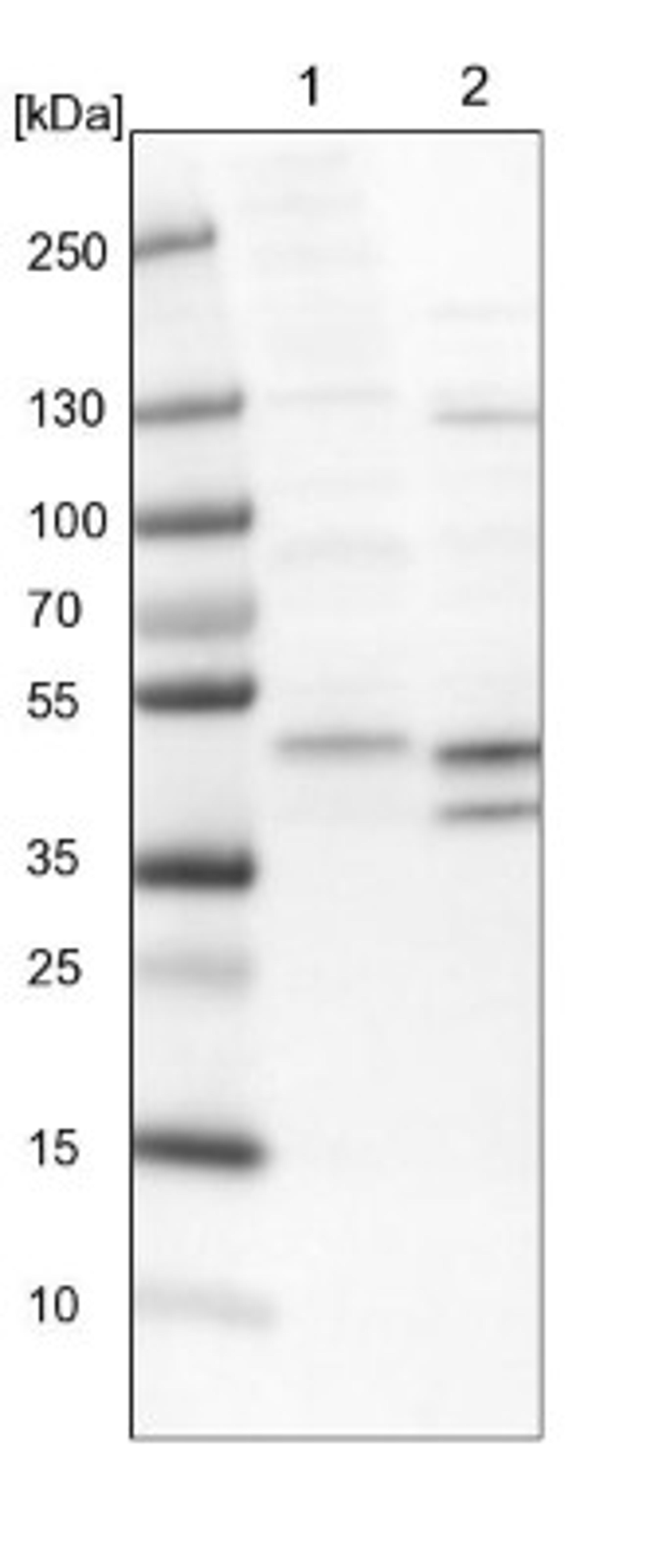 Western Blot: ECSIT Antibody [NBP1-91858] - Lane 1: NIH-3T3 cell lysate (Mouse embryonic fibroblast cells)<br/>Lane 2: NBT-II cell lysate (Rat Wistar bladder tumour cells)