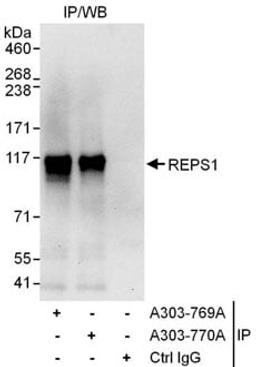 Detection of human REPS1 by western blot of immunoprecipitates.