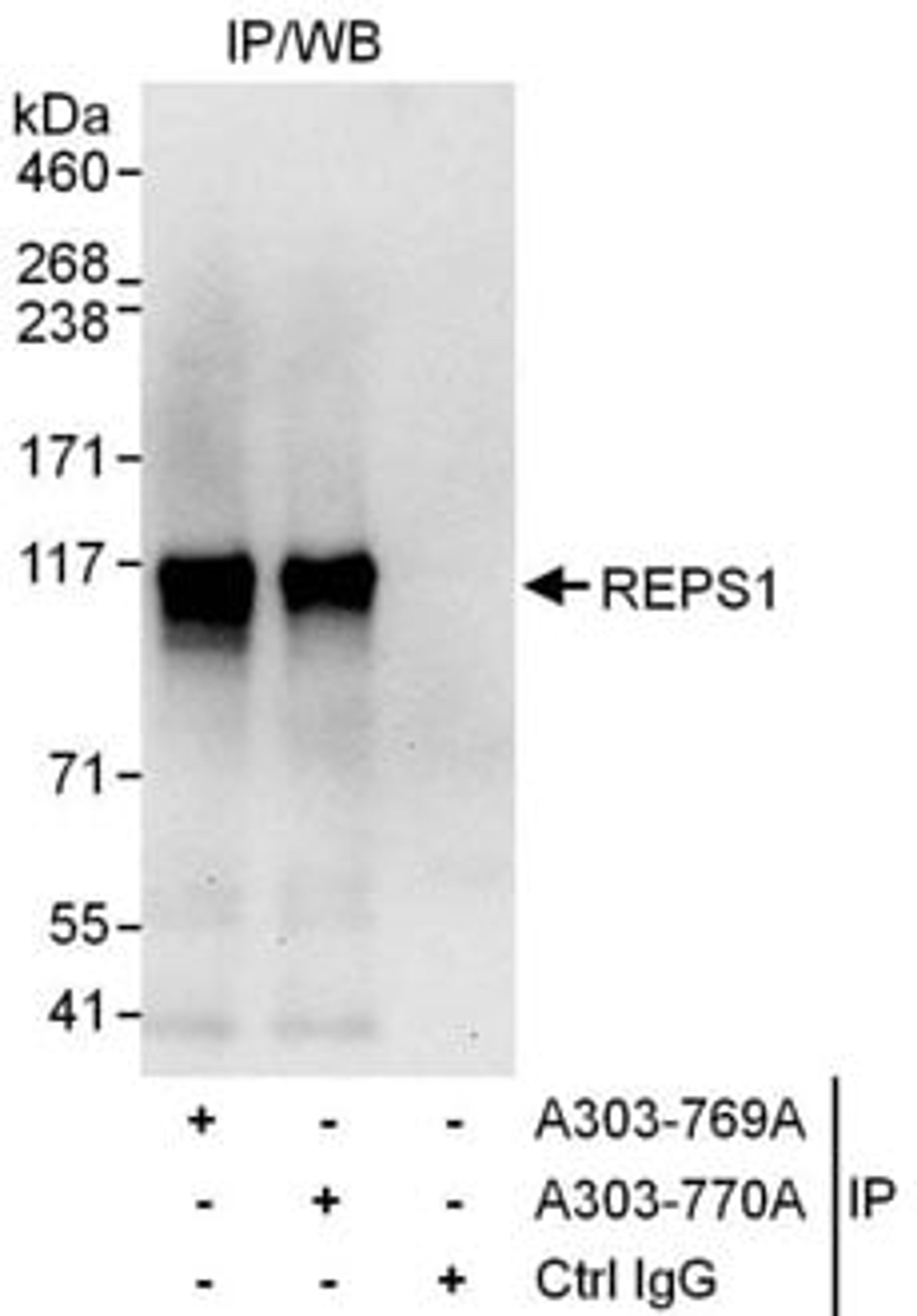 Detection of human REPS1 by western blot of immunoprecipitates.