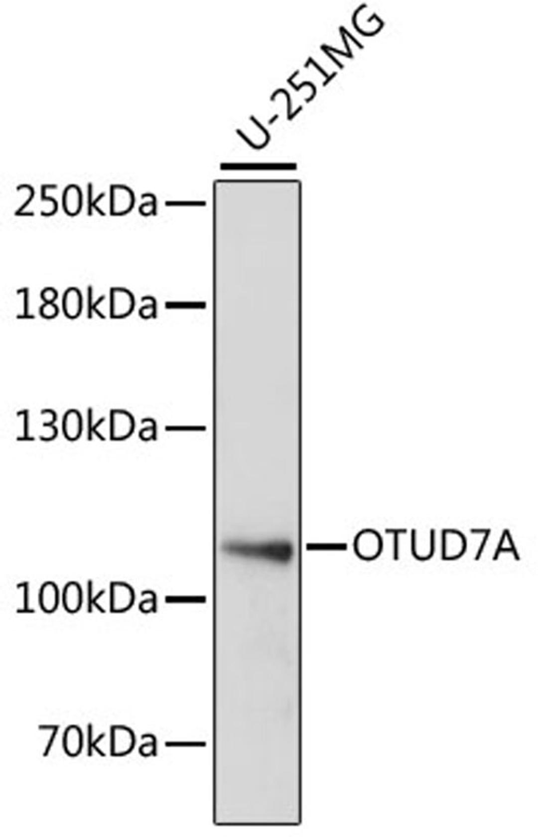 Western blot - OTUD7A antibody (A15571)