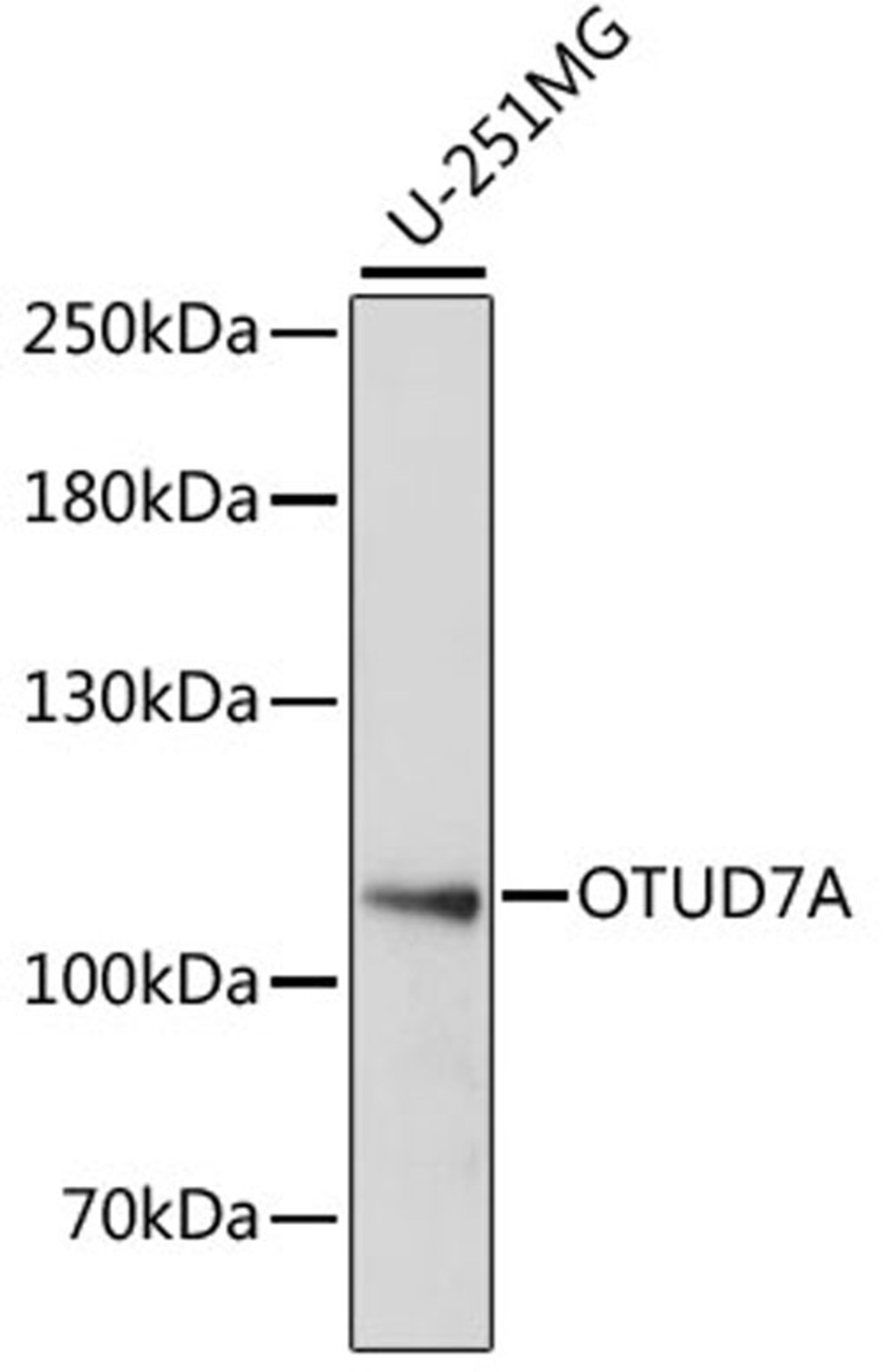 Western blot - OTUD7A antibody (A15571)