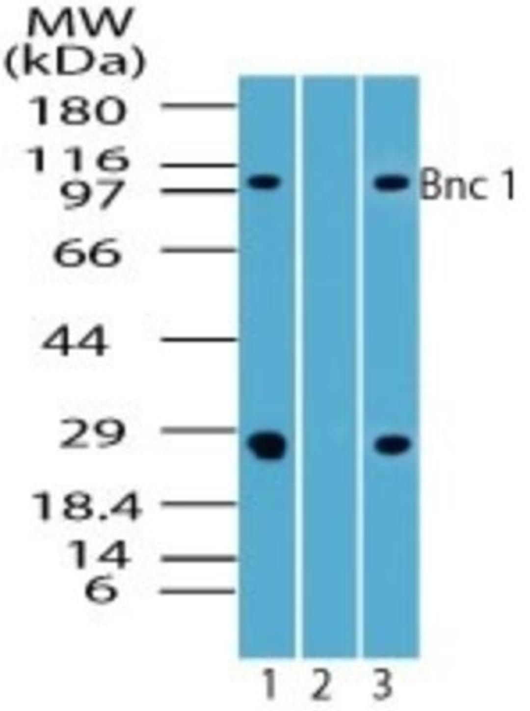 Western Blot: BNC1 Antibody [NBP2-24721] - Analysis of BNC1 in human spleen lysate in the 1) absence and 2) presence of immunizing peptide, and 3) rat lysate using NBP2-24721 at 7 ug/ml and 4 ug/ml, respectively.