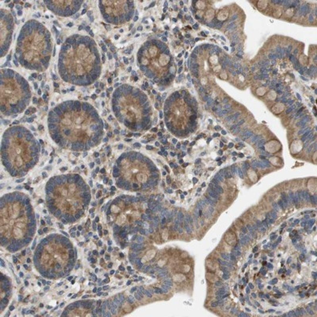 Immunohistochemistry-Paraffin: SLC25A20 Antibody [NBP1-86690] - Staining of human small intestine shows moderate cytoplasmic positivity in glandular cells.